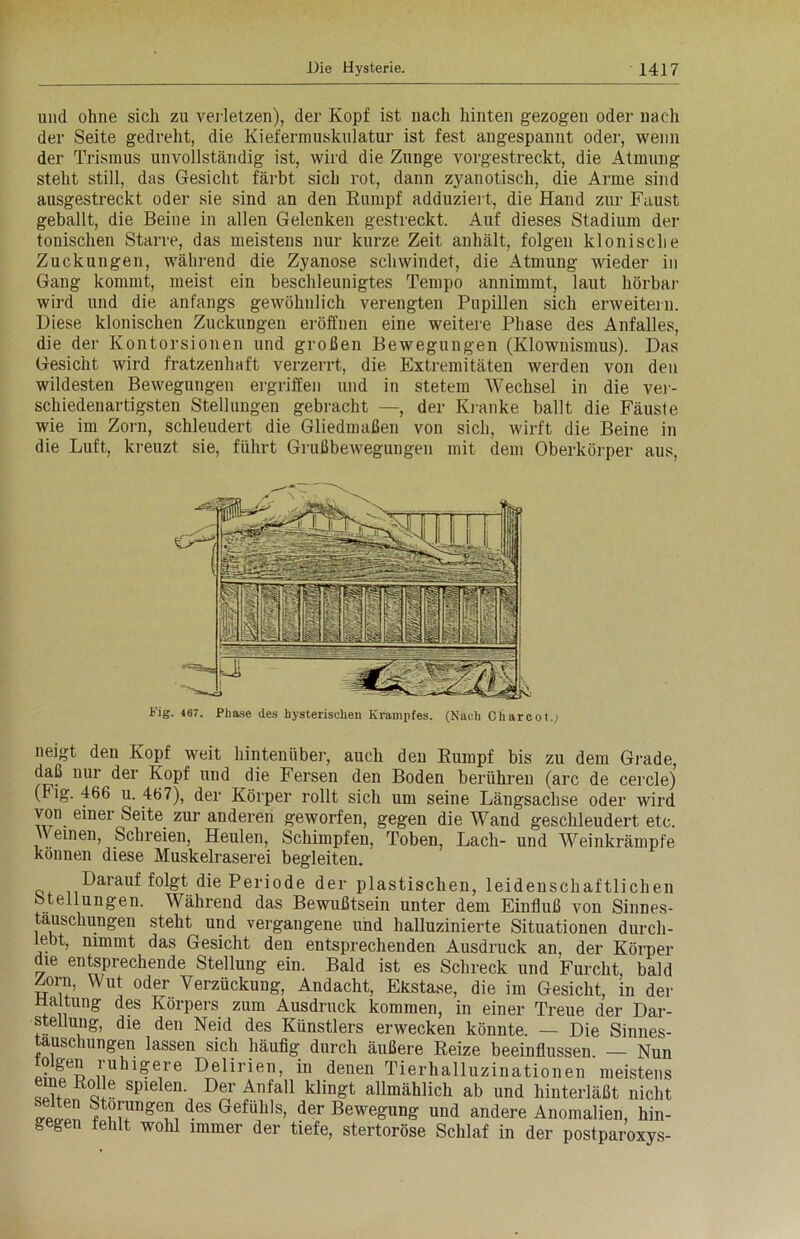 und ohne sich zu verletzen), der Kopf ist nach hinten gezogen oder nach der Seite gedreht, die Kiefermuskulatur ist fest angespannt oder, wenn der Trismus unvollständig ist, wird die Zunge vorgestreckt, die Atmung steht still, das Gesicht färbt sich rot, dann zyanotisch, die Arme sind ausgestreckt oder sie sind an den Rumpf adduziert, die Hand zur Faust geballt, die Beine in allen Gelenken gestreckt. Auf dieses Stadium der tonischen Starre, das meistens nur kurze Zeit anhält, folgen klonische Zuckungen, während die Zyanose schwindet, die Atmung wieder in Gang kommt, meist ein beschleunigtes Tempo annimmt, laut hörbar wird und die anfangs gewöhnlich verengten Pupillen sich erweitern. Diese klonischen Zuckimgen eröffnen eine weitere Phase des Anfalles, die der Kontorsionen und großen Bewegungen (Klownismus). Das Gesicht wird fratzenhaft verzerrt, die Extremitäten werden von den wildesten Bewegungen ergriffen und in stetem Wechsel in die ver- schiedenartigsten Stellungen gebracht —, der Kranke ballt die Fäuste wie im Zorn, schleudert die Gliedmaßen von sich, wirft die Beine in die Luft, kreuzt sie, führt Grußbewegungen mit dem Oberkörper aus, Kig. 467. Phase des hysterischen Krampfes. (Nach C har cot.; neigt den Kopf weit hintenüber, auch den Rumpf bis zu dem Grade, daß nur der Kopf und die Fersen den Boden berühren (arc de cercle) (Fig. 466 u. 467), der Körper rollt sich um seine Längsachse oder wird von einer Seite, zur anderen geworfen, gegen die Wand geschleudert etc. ' einen, Schreien, Heulen, Schimpfen, Toben, Lach- und Weinkrämpfe können diese Muskelraserei begleiten. Darauf folgt die Periode der plastischen, leidenschaftlichen Stellungen. Während das Bewußtsein unter dem Einfluß von Sinnes- täuschungen steht und vergangene und halluzinierte Situationen durch- lebt, nimmt das Gesicht den entsprechenden Ausdruck an, der Körper die entsprechende Stellung ein. Bald ist es Schreck und Furcht, bald Zorn, Wut oder Verzückung, Andacht, Ekstase, die im Gesicht, in der Haltung des Körpers zum Ausdruck kommen, in einer Treue der Dar- stellung, die den Neid des Künstlers erwecken könnte. — Die Sinnes- täuschungen lassen sich häufig durch äußere Reize beeinflussen. — Nun luhi&ere Delirien, in denen Tierhalluzinationen meistens öS spielen' Der Allfa11 klin^fc allmählich ab und hinterläßt nicht f?ungn d.es Gefuhls> der Bewegung und andere Anomalien, hin- gegen fehlt wohl immer der tiefe, stertoröse Schlaf in der postparoxys-