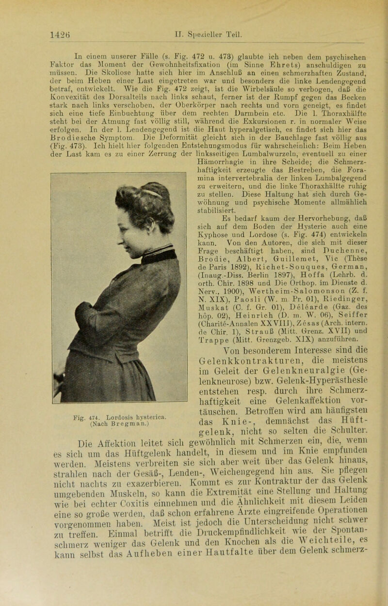 In einem unserer Fälle (s. Fig. 472 u. 473) glaubte ich neben dem psychischen Faktor das Moment der Gewohnheitsfixation (im Sinne Ehrets) anschuldigen zu müssen. Die Skoliose hatte sich hier im Anschluß an einen schmerzhaften Zustand, der beim Heben einer Last eingetreten war und besonders die linke Lendengegend betraf, entwickelt. Wie die Fig. 472 zeigt, ist die Wirbelsäule so verbogen, daß die Konvexität des Dorsalteils nach links schaut, ferner ist der Rumpf gegen das Becken stark nach links verschoben, der Oberkörper nach rechts und vorn geneigt, es findet sich eine tiefe Einbuchtung über dem rechten Darmbein etc. Die 1. Thoraxhälfte steht bei der Atmung fast völlig still, während die Exkursionen r. in normaler Weise erfolgen. In der 1. Lendengegend ist die Haut hyperalgetisch, es findet sich hier das Brodiesche Symptom. Die Deformität gleicht sich in der Bauchlage fast völlig aus (Fig. 473). Ich hielt hier folgenden Entstehnngsmodus für wahrscheinlich: Beim lieben der Last kam es zu einer Zerrung der linksseitigen Lumbalwurzeln, eventuell zu einer Häraorrhagie in ihre Scheide; die Schmerz- haftigkeit erzeugte das Bestreben, die Fora- mina intervertebralia der linken Lumbalgegend zu erweitern, und die linke Thoraxhälfte ruhig zu stellen. Diese Haltung hat sich durch Ge- wöhnung und psychische Momente allmählich stabilisiert. Es bedarf kaum der Hervorhebung, daß sich auf dem Boden der Hysterie auch eine Kyphose und Lordose (s. Fig. 474) entwickeln kann. Von den Autoren, die sich mit dieser Frage beschäftigt haben, sind Duchenne, Brodie, Albert, Guillemet, Vic (Thöse de Paris 1892), Richet-Souques, German, (Inaug.-Diss. Berlin 1897), Hoffa (Lehrb. d. orth. Chir. 1898 und Die Orthop. im Dienste d. Nerv., 1900), Wertheim-Salomonson (Z. f. N. XIX), Paosli (W. m Pr. 01), Riedinger, Muskat (0. f. Gr. 01), Delearde (Gaz. des höp. 02), Heinrich (D. in. W. 06), Seiffer (Charite-Annalen XX Vlli), Zesas (Arch. intern, de Chir. 1), Strauß (Mitt. Grenz. XVII) und Trappe (Mitt. Grenzgeb. XIX) anzuführen. Von besonderem Interesse sind die Gelenkkontrakturen, die meistens im Geleit der Gelenkneuralgie (Ge- lenkneurose) bzw. Gelenk-Hyperästhesie entstehen resp. durch ihre Schmerz- haftigkeit eine Gelenkaffektion Vor- täuschen. Betroffen wird am häufigsten das Knie-, demnächst das Hüft- gelenk, nicht so selten die Schulter. Die Affektion leitet sich gewöhnlich mit Schmerzen ein, die, wenn es sich um das Hüftgelenk handelt, in diesem und im Knie empfunden werden Meistens verbreiten sie sich aber weit über das Gelenk hinaus, strahlen nach der Gesäß-, Lenden-, Weichengegend hin aus. Sie pflegen nicht nachts zu exazerbiereu. Kommt es zur Kontraktur der das Gelen umgebenden Muskeln, so kann die Extremität eine Stellung und Haltung wie bei echter Coxitis einnehmen und die Ähnlichkeit mit diesem Leiden eine so große werden, daß schon erfahrene Arzte eingreifende Operationen vorgenommen haben. Meist ist jedoch die Unterscheidung nicht schwer zu treffen. Einmal betrifft die Druckempfindlichkeit wie der Spontan- schmerz weniger das Gelenk und den Knochen als die V eichteile, es kann selbst das Aufheben einer Hautfalte über dem Gelenk schmerz- Fig. 474. Lordosis hysterica. (Nach Bregman.)