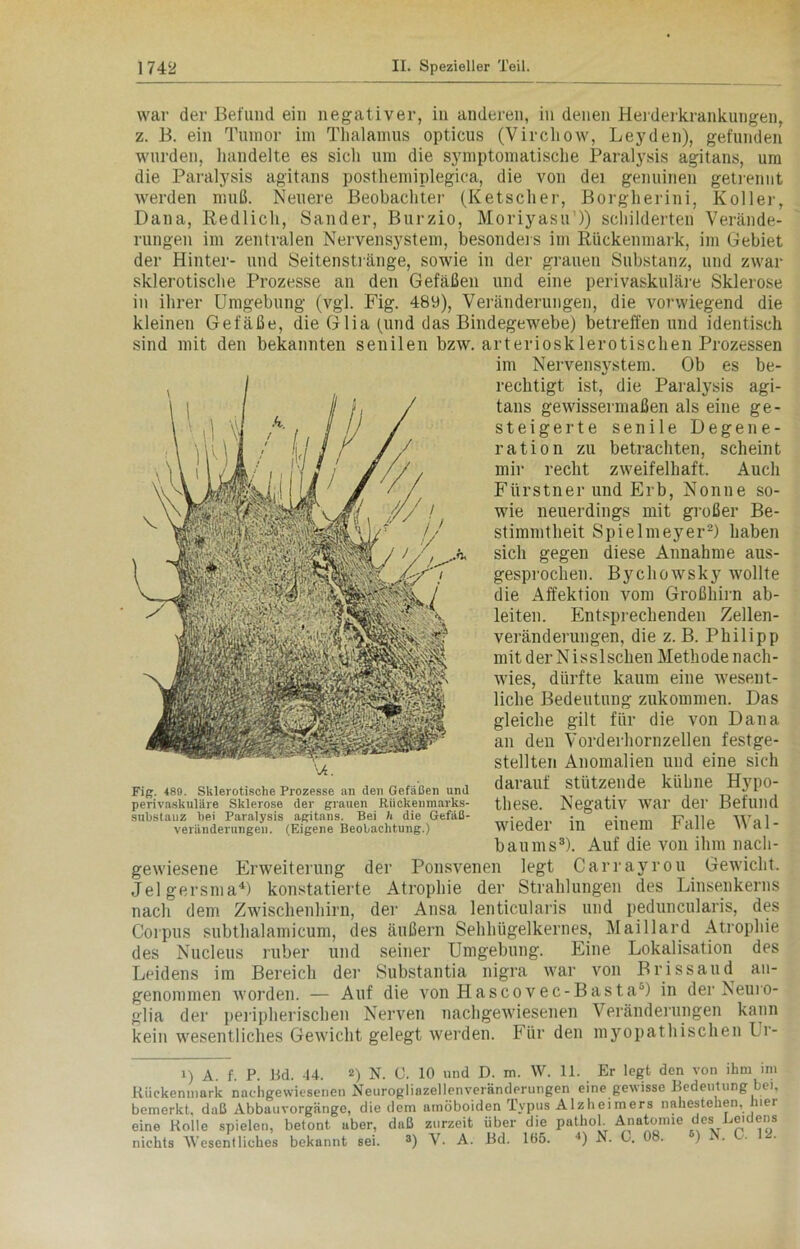 war der Befund ein negativer, in anderen, in denen Herderkrankungen, z. B. ein Tumor im Thalamus opticus (Virchow, Leyden), gefunden wurden, handelte es sich um die symptomatische Paralysis agitans, um die Paralysis agitans posthemiplegica, die von dei genuinen getrennt werden muß. Neuere Beobachter (Ketscher, Borgherini, Koller, Dana, Redlich, Sander, Burzio, Moriyasu’)) schilderten Verände- rungen im zentralen Nervensystem, besonders im Rückenmark, im Gebiet der Hinter- und Seitenstränge, sowie in der grauen Substanz, und zwar sklerotische Prozesse an den Gefäßen und eine perivaskuläre Sklerose in ihrer Umgebung (vgl. Fig. 489), Veränderungen, die vorwiegend die kleinen Gefäße, die Glia (und das Bindegewebe) betreffen und identisch sind mit den bekannten senilen bzw. arteriosklerotischen Prozessen gewiesene Erweiterung der Ponsvenen legt Carrayrou Gewicht. Jelgersma4) konstatierte Atrophie der Strahlungen des Linsenkerns nach dem Zwischenhirn, der Ansa lenticularis und peduncularis, des Corpus subthalamicum, des äußern Sehhügelkernes, Maillard Atrophie des Nucleus ruber und seiner Umgebung. Eine Lokalisation des Leidens im Bereich der Substantia nigra war von Brissaud an- genommen worden. — Auf die von Hascovec-BastaJ) in der Neuro- glia der peripherischen Nerven nachgewiesenen Veränderungen kann kein wesentliches Gewicht gelegt werden. Für den myopathischen Ur- n A f P Hfl. 44. Z'i N. G. 10 und D. m. W. 11. Er legt den von ihm im Fig. 489. Sklerotische Prozesse an den Gefäßen und perivaskuläre Sklerose der grauen Ruckenmarks- substauz hei Paralysis agitans. Bei h die Gefäß- veränderungen. (Eigene Beobachtung.) im Nervensystem. Ob es be- rechtigt ist, die Paralysis agi- tans gewissermaßen als eine ge- steigerte senile Degene- ration zu betrachten, scheint mir recht zweifelhaft. Auch Fiirstner und Erb, Nonne so- wie neuerdings mit großer Be- stimmtheit Spielmeyer2) haben sich gegen diese Annahme aus- gesprochen. Bychowsky wollte die Affektion vom Großhirn ab- leiten. Entsprechenden Zellen- veränderungen, die z. B. Philipp mit der Nisslschen Methode nach- wies, dürfte kaum eine wesent- liche Bedeutung zukommen. Das gleiche gilt für die von Dana an den Vorderhornzellen festge- stellten Anomalien und eine sich darauf stützende kühne Hypo- these. Negativ war der Befund wieder in einem Falle Wal- baums3). Auf die von ihm nach-