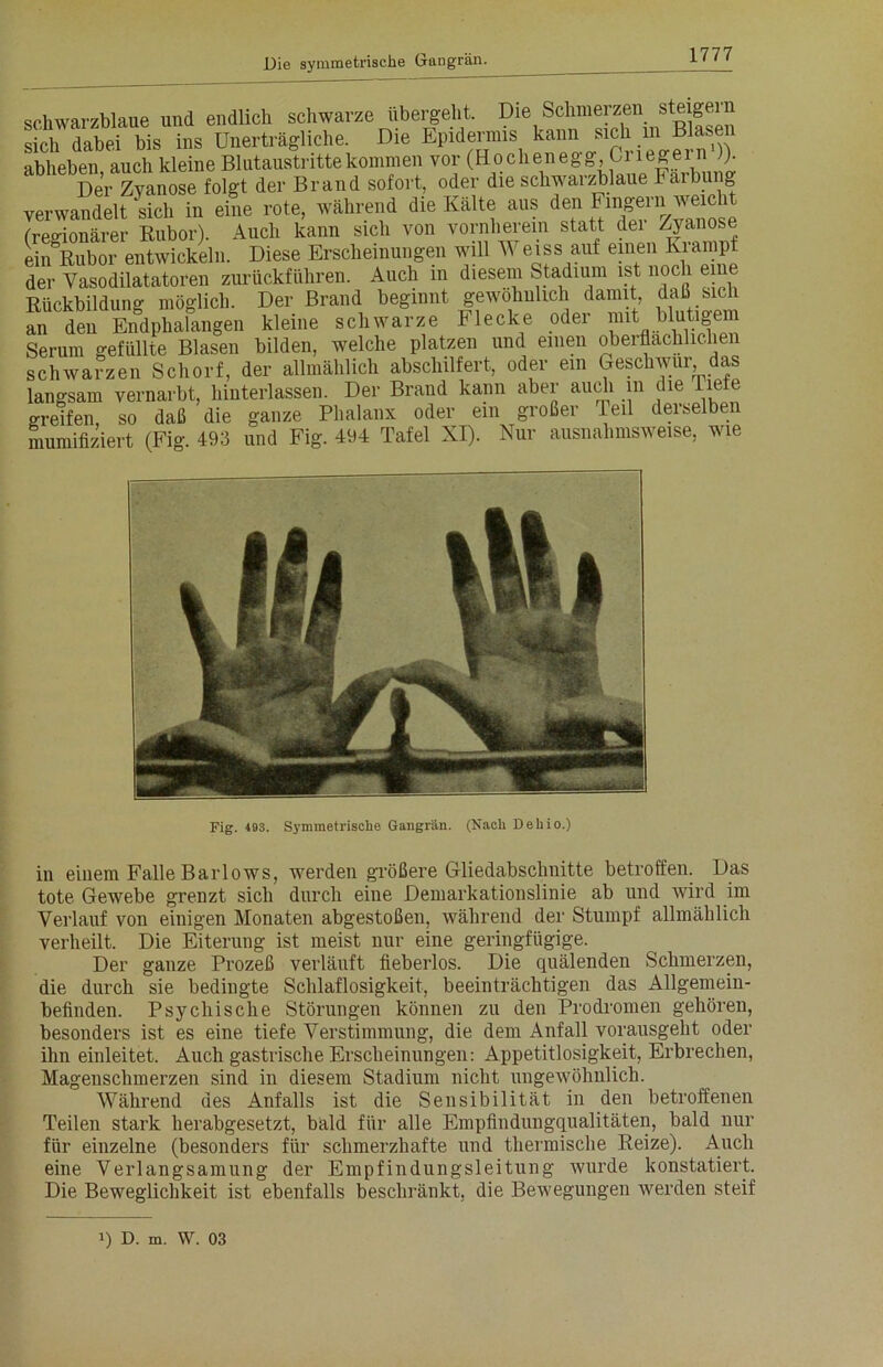 1777 schwarzblaue und endlich schwarze übergeht. Die Schmerzen steigein sich dabei bis ins Unerträgliche. Die Epidermis kann sich m Blase abheben auch kleine Blutaustritte kommen vor (Hochenegg, Gnegern )). Der Zyanose folgt der Brand sofort, oder die schwarzblaue Färbung verwandelt sich in eine rote, während die Kälte aus den (regionärer Rubor). Auch kann sich von vornherein statt dei Zyanose ein Rubor entwickeln. Diese Erscheinungen will Wegs auf einen Krampf der Vasodilatatoren zurückführen. Auch m diesem Stadium ist noch eine Rückbildung möglich. Der Brand beginnt gewöhnlich damit daß sich an den Endphalangen kleine schwarze Flecke oder mit blutigem Serum gefüllte Blasen bilden, welche platzen und einen obei Sachlichen schwarzen Schorf, der allmählich abschilfert, oder ein Geschwür das langsam vernarbt, hinterlassen. Der Brand kann aber auch m <lie iiete greifen, so daß die ganze Phalanx oder ein großer Peil derselbei mumifiziert (Fig. 493 und Fig. 494 Tafel XI). Nur ausnahmsweise, wie Fig. 493. Symmetrische Gangrän. (Nach Dehio.) in einem Falle Barlows, werden größere Gliedabschnitte betroffen. Das tote Gewebe grenzt sich durch eine Demarkationslinie ab und wird im Verlauf von einigen Monaten abgestoßen, während der Stumpf allmählich verheilt. Die Eiterung ist meist nur eine geringfügige. Der ganze Prozeß verläuft fieberlos. Die quälenden Schmerzen, die durch sie bedingte Schlaflosigkeit, beeinträchtigen das Allgemein- befinden. Psychische Störungen können zu den Prodromen gehören, besonders ist es eine tiefe Verstimmung, die dem Anfall vorausgeht oder ihn einleitet. Auch gastrische Erscheinungen: Appetitlosigkeit, Erbrechen, Magenschmerzen sind in diesem Stadium nicht ungewöhnlich. Während des Anfalls ist die Sensibilität in den betroffenen Teilen stark herabgesetzt, bald für alle Empfindungqualitäten, bald nur für einzelne (besonders für schmerzhafte und thermische Reize). Auch eine Verlangsamung der Empfindungsleitung wurde konstatiert. Die Beweglichkeit ist ebenfalls beschränkt, die Bewegungen werden steif J) D. m. W. 03