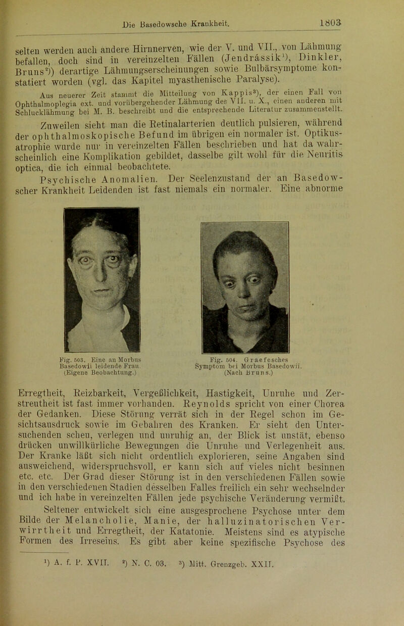 selten werden auch andere Hirnnerven, wie der V. und VII., von Lähmung- befallen, doch sind in vereinzelten Fällen (Jendrässik1), Dinkler, Bruns2)) derartige Lähmungserscheinungen sowie Bulbärsymptome kon- statiert worden (vgl. das Kapitel myasthenische Paralyse). Aus neuerer Zeit stammt die Mitteilung von Käppis»), der einen Fall von Ophthalmoplegia ext. und vorübergehender Lähmung des V II. u. X., einen anderen mit Schlucklähmung bei M. B. beschreibt und die entsprechende Literatur zusammenstellt. Zuweilen sieht man die Retinalarterien deutlich pulsieren, während der ophthalmoskopische Befund im übrigen ein normaler ist. Optikus- atrophie wurde nur in vereinzelten Fällen beschrieben und hat da wahr- scheinlich eine Komplikation gebildet, dasselbe gilt wohl für die Neuritis optica, die ich einmal beobachtete. Psychische Anomalien. Der Seelenzustand der an Basedow- scher Krankheit Leidenden ist fast niemals ein normaler. Eine abnorme Erregtheit, Reizbarkeit, Vergeßlichkeit, Hastigkeit, Unruhe und Zer- streutheit ist fast immer vorhanden. Reynolds spricht von einer Chorea der Gedanken. Diese Störung verrät sich in der Regel schon im Ge- sichtsausdruck sowie im Gebühren des Kranken. Er sieht den Unter- suchenden scheu, verlegen und unruhig an, der Blick ist nnstät, ebenso drücken unwillkürliche Bewegungen die Unruhe und Verlegenheit aus. Der Kranke läßt sich nicht ordentlich explorieren, seine Angaben sind ausweichend, widerspruchsvoll, er kann sich auf vieles nicht besinnen etc. etc. Der Grad dieser Störung ist in den verschiedenen Fällen sowie in den verschiedenen Stadien desselben Falles freilich ein sehr wechselnder und ich habe in vereinzelten Fällen jede psychische Veränderung vermißt. Seltener entwickelt sich eine ausgesprochene Psychose unter dein Bilde der Melancholie, Manie, der halluzinatorischen Ver- wirrtheit und Erregtheit, der Katatonie. Meistens sind es atypische Formen des Irreseins. Es gibt aber keine spezifische Psychose des Fig. 503. Eine an Morbus Basedowii leidende Frau (Eigene Beobachtung.) Fig. 504. Graefesches Symptom bei Morbus Basedowii. (Nach Bruns.) !) A. f. P. XVIT. 2) N. C. 03. ») Mitt. Grenzgeb. XXII.