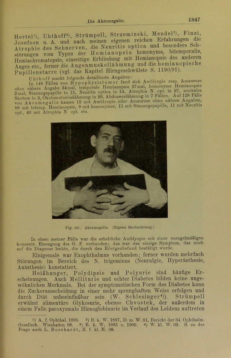 Hertel1), Josefson Atrophie Störungen Ulithoff2). Strümpell, Strzeminski, Mendel3), Finzi, u. A. und nach meinen eigenen reichen Erfahrungen die des Sehnerven, die Neuritis optica und besondeis Seh- »uiruuKBu vom Typus der Hemianopsia homonyma, bitemporalis, Hemiachromatopsie, einseitige Erblindung mit Hemianopsie des anderen A.Uges etc ferner die Augenmuskellähmung und die hennanopische Pupillenstarre (vgl. das Kapitel Hirngeschwülste S. 1190/91). Uhthoff macht folgende detaillierte Angaben: . ln 148 Fällen von Hypophysistumor fand sich Amblyopie resp. Amaurose ohne nähere Angabe 34 mal, temporale Hemianopsie 37mal, homonyme Hemianopsie 2 mal, Stauungspapille in 15, Neuritis optica in 14 Atrophia N. opt. in -7 zentrales Skotom in 3, Okulomotoriuslähmung in 2(1, Abduzenslähmung in / Fallen. Aut 1-8 . von Akromegalie kamen 15 mit Amblyopie oder Amaurose ohne nähere Angaben, 89 mit bitemp. Hemianopsie, 9 mit homonymer, 11 mit Stauungspapille, 11 mit Neuritis opt,, 40 mit Atrophia N opt. etc. Fig. 521. Akromegalie. (Eigene Beobachtung.) In einen meiner Fälle war die erhebliche Amblyopie mit einer unregelmäßigen konzentr. Einengung des G. F. verbunden; das war das einzige Symptom, das mich auf die Diagnose lenkte, die durch den Röntgenbefund bestätigt wurde. Einigemale war Exophthalmus vorhanden; ferner wurden mehrfach Störungen im Bereich des N. trigeminus (Neuralgie, Hyperästhesie, Anästhesie) konstatiert. Heißhunger, Polydipsie und Polyurie sind häufige Er- scheinungen. Auch Melliturie und echter Diabetes bilden keine unge- wöhnlichen Merkmale. Bei der symptomatischen Form des Diabetes kann die Zuckerausscheidung in einer mehr sprunghaften Weise erfolgen und durch Diät unbeeinflußbar sein (W. Schlesinger4)). Strümpell erwähnt alimentäre Glykosurie, ebenso Chvostek, der außerdem in einem Falle paroxysmale Hämoglobinurie im Verlauf des Leidens auf treten !) A. f. Ophthal. 1895. 2) B. k. AVI 1897, D. m. W. 01, Bericht der 34. Ophthalm. Gesellsch. AViesbaden 08. 3) B. k. AV. 1895 u. 1900. 4) W. kl. A\r. 02. S. zu der Frage auch L. Borchardt, Z. f. kl. M. 08.