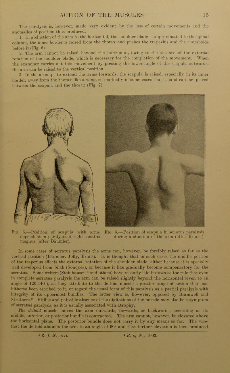 The paralysis is, however, made very evident by the loss of certain movements and the anomalies of position thus produced. 1. In abduction of the arm to the horizontal, the shoulder blade is approximated to the spinal column, the inner border is raised from the thorax and pushes the trapezius and the rhomboids before it (Fig. 6). 2. The arm cannot be raised beyond the horizontal, owing to the absence of the external rotation of the shoulder blade, which is necessary for the completion of the movement. When the examiner carries out this movement by pressing the lower angle of the scapula outwards, the arm can be raised to the vertical position. 3. In the attempt to extend the arms forwards, the scapula is raised, especially in its inner border, away from the thorax like a wing, so markedly in some cases that a hand can be placed between the scapula and the thorax (Fig. 7). Fig. 5.—Position of scapula with arms Fig. 6.—Position of scapula in senatus paralysis dependent in paralysis of right senatus during abduction of ihe arm (after Bruns.) magnus (after Baumler). In some cases of serratus paralysis the arms can, however, be forcibly raised as far as the vertical position (Baumler, Jolly, Bruns). It is thought that in such cases the middle portion of the trapezius effects the external rotation of the shoulder blade, either because it is specially well developed from birth (Souques), or because it has gradually become compensatory for the serratus. Some writers (Steinhausen 1 and others) have recently laid it down as the rule that even in complete serratus paralysis the arm can be raised slightly beyond the horizontal (even to an angle of 120-140°), as they attribute to the deltoid muscle a greater range of action than has hitherto been ascribed to it, or regard the usual form of this paralysis as a partial paralysis with integrity of its uppermost bundles. The latter view is, however, opposed by Bramwell and Struthers.2 Visible and palpable absence of the digitations of the muscle may also be a symptom of serratus paralysis, as it is usually associated with atrophy. The deltoid muscle moves the arm outwards, forwards, or backwards, according as its middle, anterior, or posterior bundle is contracted. The arm cannot, however, be elevated above the horizontal plane. The posterior bundle does not carry it by any means so far. The view that the deltoid abducts the arm to an angle of 90° and that further elevation is then produced 1 Z. f. N., xvi. 2 E. of N., 1903.