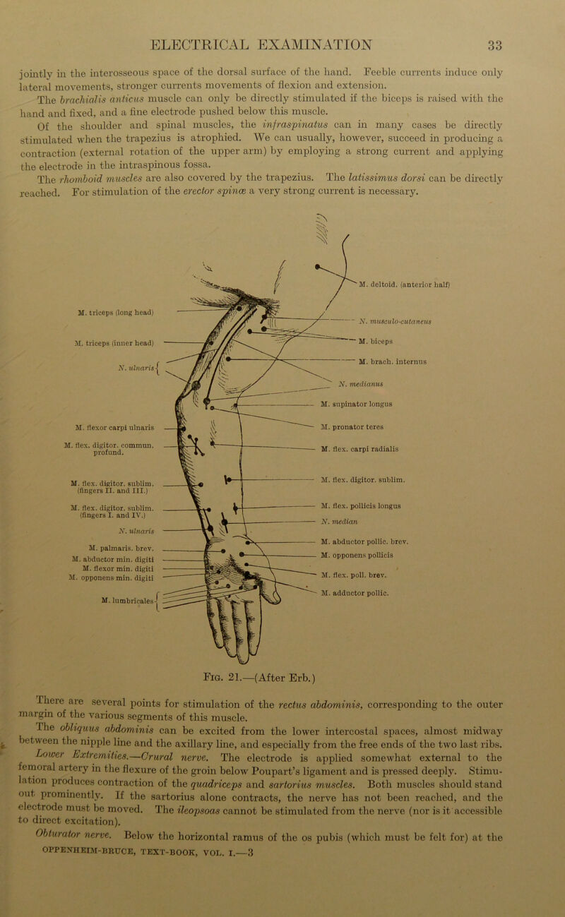 jointly in the interosseous space of the dorsal surface of the hand. Feeble currents induce only lateral movements, stronger currents movements of flexion and extension. The brachialis anticus muscle can only be directly stimulated if the biceps is raised with the hand and fixed, and a fine electrode pushed below this muscle. Of the shoulder and spinal muscles, the infraspinatus can in many cases be directly stimulated when the trapezius is atrophied. We can usually, however, succeed in producing a contraction (external rotation of the upper arm) by employing a strong current and applying the electrode in the intraspinous fossa. The rhomboid muscles are also covered by the trapezius. The latissimus dorsi can be directly reached. For stimulation of the erector spince a very strong current is necessary. M. triceps (long head) M. triceps (inner head) V. ulnaris { M. flexor carpi ulnaris M. flex, digitor. common, profund. M. Ilex, digitor. subhm. (fingers II. and III.) M. flex, digitor. sublim. (fingers I. and IV.) N. ulnaris M. palmaris. hrev. M. abductor min. digiti M. flexor min. digiti M. opponens min. digiti M. lumbricales / l 'M. deltoid, (anterior half) N. musculo-cutaneus M. biceps M. brach. interims N. medianus M. supinator longus M. pronator teres M. flex, carpi radialis M. flex, digitor. sublim. M. flex, pollicis longus N. median M. abductor pollic. brev. M. opponens pollicis / M. flex. poll. brev. M. adductor pollic. Fig. 21.—(After Erb.) Ihere are several points for stimulation of the rectus abdominis, corresponding to the outer margin of the various segments of this muscle. 1 lie obliquus abdominis can be excited from the lower intercostal spaces, almost midway between the nipple line and the axillary line, and especially from the free ends of the two last ribs. Lower Extremities.—Crural nerve. The electrode is applied somewhat external to the femoral artery in the flexure of the groin below Poupart’s ligament and is pressed deeply. Stimu- lation produces contraction of the quadriceps and sartorius muscles. Both muscles should stand out piominently. If the sartorius alone contracts, the nerve has not been reached, and the electrode must be moved. The ileopsocis cannot be stimulated from the nerve (nor is it accessible to direct excitation). Obturator nerve. Below the horizontal ramus of the os pubis (which must be felt for) at the OPPENHEIM-BRUCE, TEXT-BOOK, VOL. I. 3