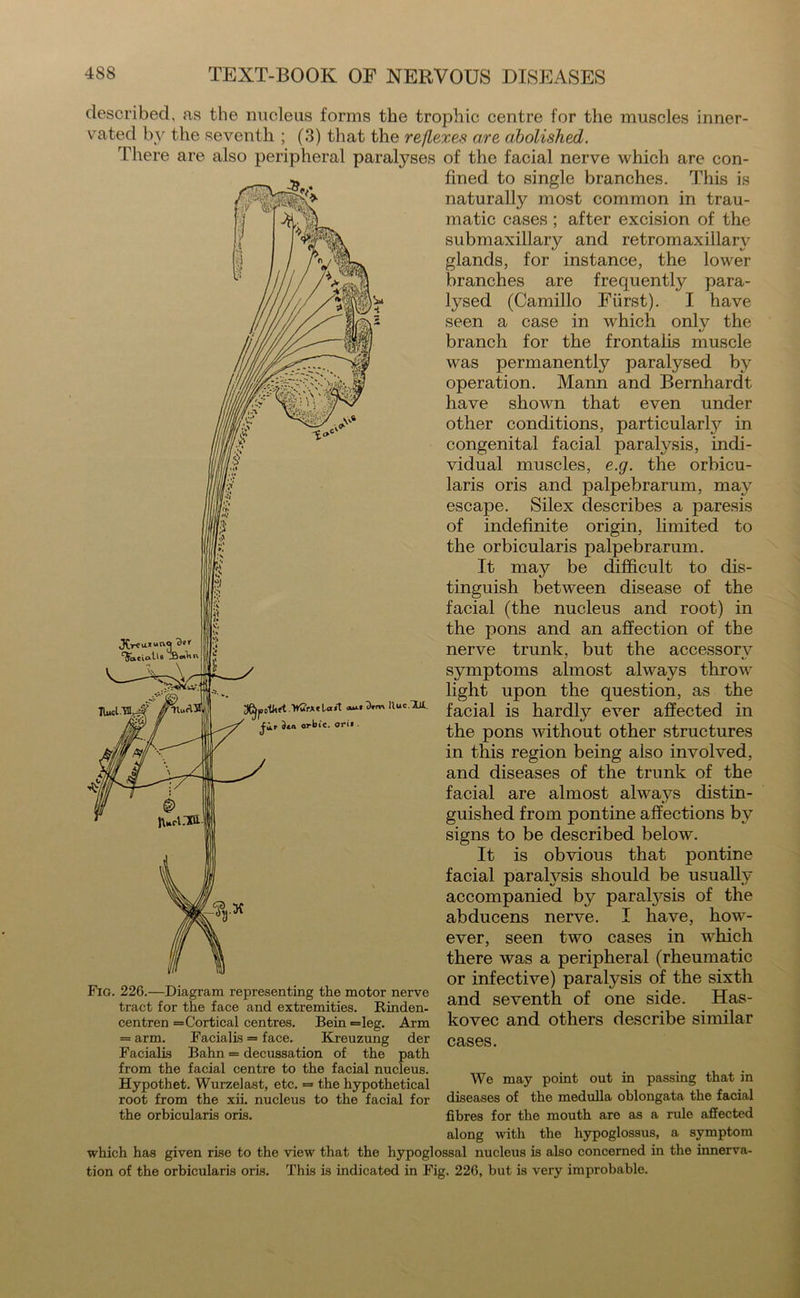 described, as the nucleus forms the trophic centre for the muscles inner- vated by the seventh ; (3) that the reflexes are abolished. There are also peripheral paralyses of the facial nerve which are con- fined to single branches. This is naturally most common in trau- matic cases ; after excision of the submaxillary and retromaxillarv glands, for instance, the lower branches are frequently para- lysed (Camillo Fiirst). I have seen a case in which onlv the branch for the frontalis muscle was permanently paralysed by operation. Mann and Bernhardt have shown that even under other conditions, particular^ in congenital facial paralysis, indi- vidual muscles, e.g. the orbicu- laris oris and palpebrarum, may escape. Silex describes a paresis of indefinite origin, limited to the orbicularis palpebrarum. It may be difficult to dis- tinguish between disease of the facial (the nucleus and root) in the pons and an affection of the nerve trunk, but the accessory symptoms almost always throw light upon the question, as the facial is hardly ever affected in the pons without other structures in this region being also involved, and diseases of the trunk of the facial are almost always distin- guished from pontine affections by signs to be described below. It is obvious that pontine facial paralysis should be usually accompanied bjr paratysis of the abducens nerve. I have, how- ever, seen two cases in which there was a peripheral (rheumatic or infective) paralysis of the sixth and seventh of one side. Has- kovec and others describe similar cases. We may point out in passing that in diseases of the medulla oblongata the facial fibres for the mouth are as a rule affected a Fig. 226.—Diagram representing the motor nerve tract for the face and extremities. Rinden- centren =Cortical centres. Bein >=leg. Arm = arm. Facialis = face. Kreuzung der Facialis Bahn = decussation of the path from the facial centre to the facial nucleus. Hypothet. Wurzelast, etc. = the hypothetical root from the xii. nucleus to the facial for the orbicularis oris. along with the hypoglossus, a symptom which has given rise to the view that the hypoglossal nucleus is also concerned in the innerva- tion of the orbicularis oris. This is indicated in Fig. 226, but is very improbable.