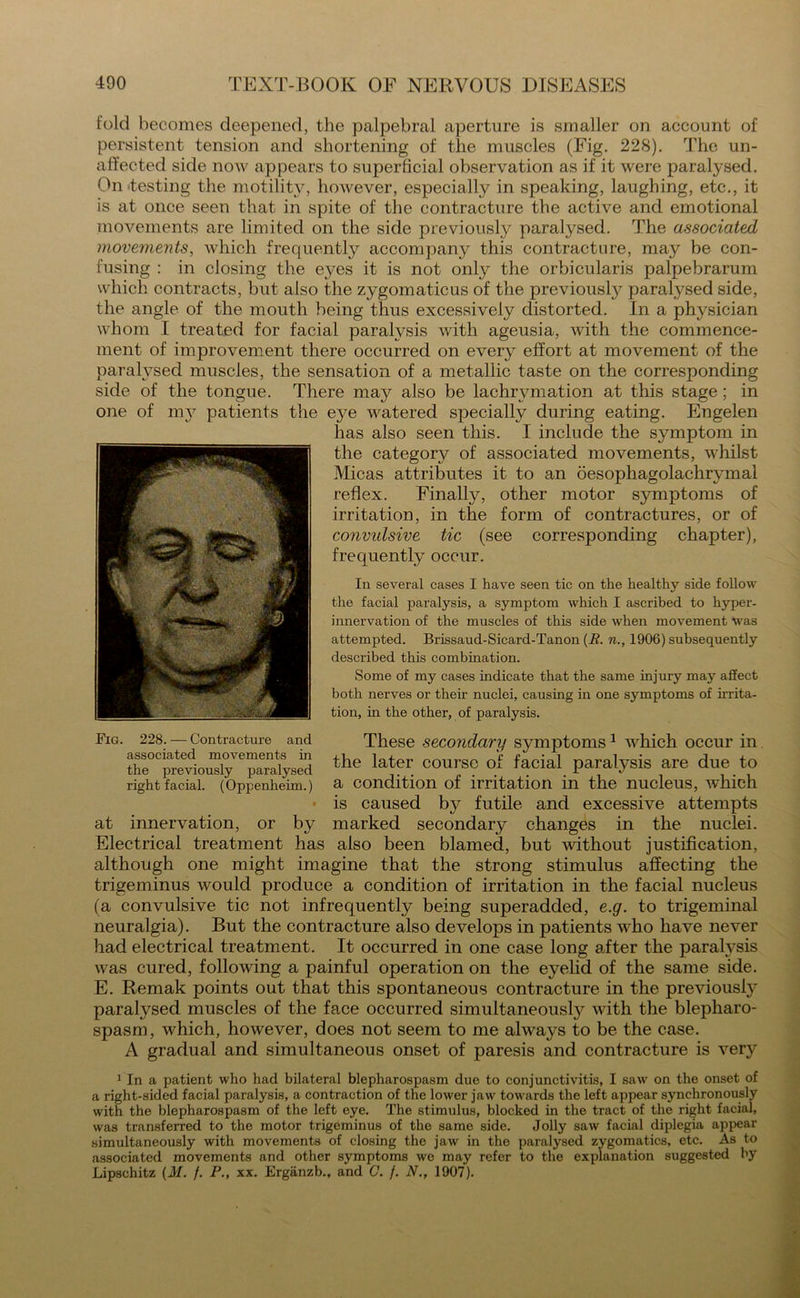 fold becomes deepened, the palpebral aperture is smaller on account of persistent tension and shortening of the muscles (Fig. 228). The un- affected side now appears to superficial observation as if it were paralysed. On testing the motility, however, especially in speaking, laughing, etc., it is at once seen that in spite of the contracture the active and emotional movements are limited on the side previously paralysed. The associated movements, which frequently accompany this contracture, may be con- fusing : in closing the eyes it is not only the orbicularis palpebrarum which contracts, but also the zygomaticus of the previously paralysed side, the angle of the mouth being thus excessively distorted. In a physician whom I treated for facial paralysis with ageusia, with the commence- ment of improvement there occurred on every effort at movement of the paralysed muscles, the sensation of a metallic taste on the corresponding side of the tongue. There may also be lachrvmation at this stage; in one of m37 patients the eye watered specially during eating. Engelen has also seen this. I include the symptom in the category of associated movements, whilst Micas attributes it to an oesophagolachrymal reflex. Finally, other motor symptoms of irritation, in the form of contractures, or of convulsive tic (see corresponding chapter), frequently occur. In several cases I have seen tic on the healthy side follow the facial paralysis, a symptom which I ascribed to hyper- innervation of the muscles of this side when movement was attempted. Brissaud-Sicard-Tanon (R. n., 1906) subsequently described this combination. Some of my cases indicate that the same injury may affect both nerves or their nuclei, causing in one symptoms of irrita- tion, in the other, of paralysis. These secondary symptoms1 which occur in the later course of facial paralysis are due to a condition of irritation in the nucleus, which is caused by futile and excessive attempts marked secondary changes in the nuclei. Electrical treatment has also been blamed, but -without justification, although one might imagine that the strong stimulus affecting the trigeminus would produce a condition of irritation in the facial nucleus (a convulsive tic not infrequently being superadded, e.g. to trigeminal neuralgia). But the contracture also develops in patients who have never had electrical treatment. It occurred in one case long after the paralysis was cured, following a painful operation on the eyelid of the same side. E. Remak points out that this spontaneous contracture in the previous^ paralysed muscles of the face occurred simultaneously with the blepharo- spasm, which, however, does not seem to me always to be the case. A gradual and simultaneous onset of paresis and contracture is very 1 In a patient who had bilateral blepharospasm due to conjunctivitis, I saw on the onset of a right-sided facial paralysis, a contraction of the lower jaw towards the left appear synchronously with the blepharospasm of the left eye. The stimulus, blocked in the tract of the right facial, was transferred to the motor trigeminus of the same side. Jolly saw facial diplegia appear simultaneously with movements of closing the jaw in the paralysed zygomatics, etc. As to associated movements and other symptoms we may refer to the explanation suggested by Lipschitz (M. /. P., xx. Erganzb., and C. f. N., 1907). Fig. 228. — Contracture and associated movements in the previously paralysed right facial. (Oppenheim.) at innervation, or by