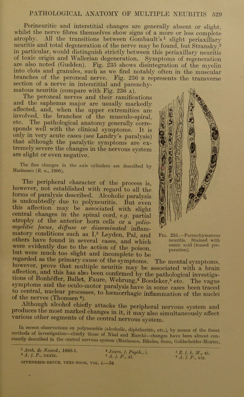 Perineuritic and interstitial changes are generally absent or slight, whilst the nerve fibres themselves show signs of a more or less complete atrophy. All the transitions between Gombault's1 slight periaxillary neuritis and total degeneration of the nerve may be found, but Stransky,2 in particular, would distinguish strictly between this periaxillary neuritis of toxic origin and Wallerian degeneration. Symptoms of regeneration are also noted (Gudden). Fig. 235 shows disintegration of the myelin into clots and granules, such as we find notably often in the muscular branches of the peroneal nerve. Fig. 236 b represents the transverse section of a nerve in interstitial and parenchy- matous neuritis (compare with Fig. 236 a). The peroneal nerves and their ramifications and the saphenus major are usually markedly affected, and, when the upper extremities are involved, the branches of the musculo-spiral, etc. The pathological anatomy generally corre- sponds well with the clinical symptoms. It is only in very acute cases (see Landry's paralysis) that although the paralytic symptoms are ex- tremely severe the changes in the nervous system are slight or even negative. The fine changes in the axis cylinders are described by Marinesco (B. n., 1906). The peripheral character of the process is, however, not established with regard to all the forms of paralysis described. Alcoholic paralysis is undoubtedly due to polyneuritis. But even this affection may be associated with slight central changes in the spinal cord, e.g. partial atrophy of the anterior horn cells or a 'polio- myelitic focus, diffuse or disseminated inflam- matory conditions such as. I,3 Leyden, Pal, and others have found in several cases, and which were evidently due to the action of the poison, but were much too slight and incomplete to be regarded as the primary cause of the symptoms. The mental symptoms, owever, prove that multiple neuritis may be associated with a brain a ec ion, an this has also been confirmed by the pathological investiga- tions of Bonhoffer, Ballet, Faure, Wehrung,4 Boedeker,5 etc. The vagus s_ymp oms an the oculo-motor paralysis have in some cases been traced o cen ra , nuc ear processes, to haemorrhagic inflammation of the nuclei of the nerves (Thomsen 6). Although alcohol chiefly attacks the peripheral nervous system and pro uces le most marked changes in it, it may also simultaneously affect various other segments of the central nervous system. In recent observations on polyneuritis (alcoholic, diphtheritic, etc.), by means of the finest me o s o investigation chiefly those of Nissl and Marclii—changes have been almost con- stantly described in the central nervous system (Marinesco, Bikeles, Sano, Goldscheider-Moxter, Fig. 235.—Parenchymatous neuritis. Stained with osmic acid (teased pre- paration). 1 Arch, de Neurol., 1880-1. 4 A. f. P., xxxix. 2 Journ. f. Psych,, i. 5 A. f. P., xl. OFPENHEIM-BRUCE, TEXT-BOOK, VOL. I. 34 3 Z. /. k. M., Xi. °A. f. P., xix.