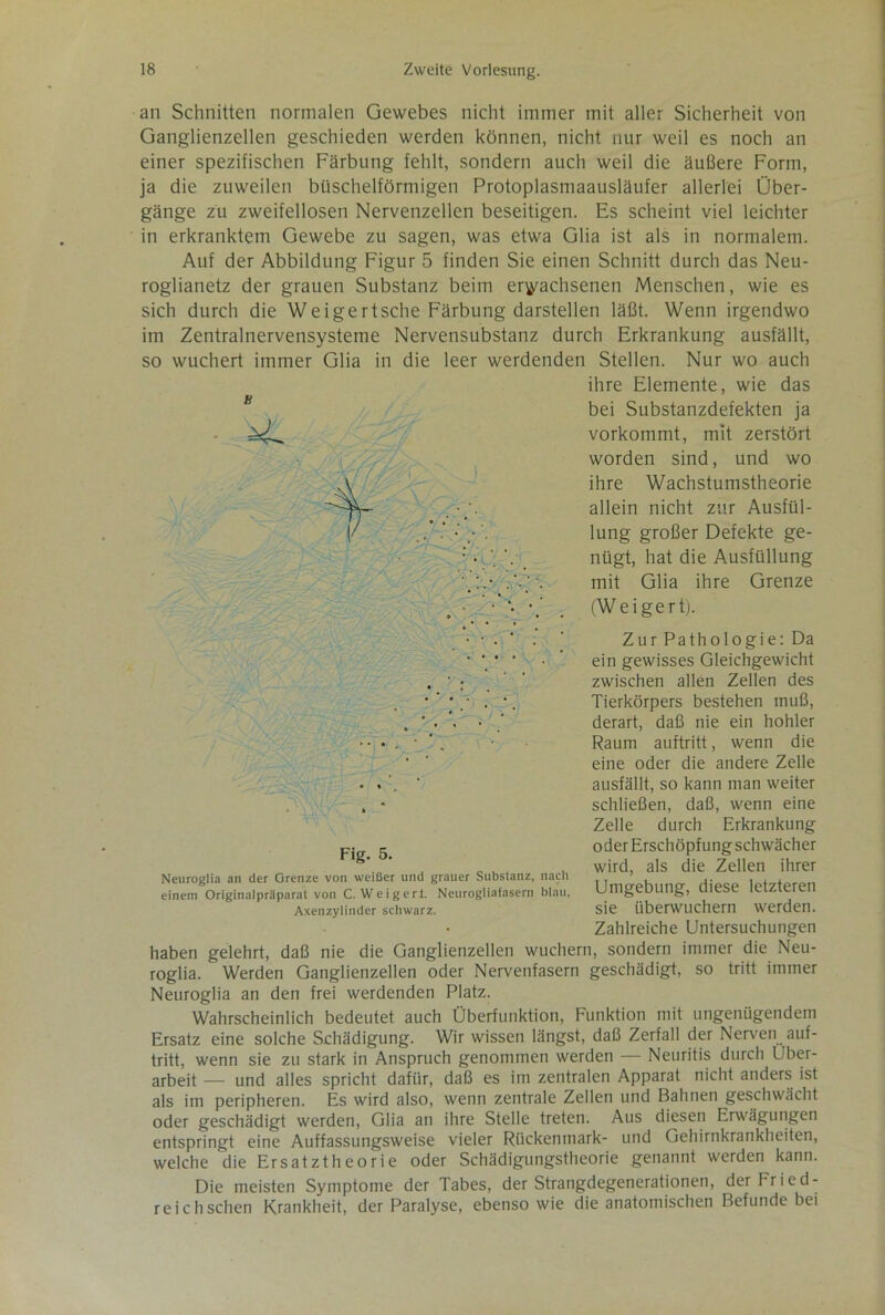 an Schnitten normalen Gewebes nicht immer mit aller Sicherheit von Ganglienzellen geschieden werden können, nicht nur weil es noch an einer spezifischen Färbung fehlt, sondern auch weil die äußere Form, ja die zuweilen büschelförmigen Protoplasmaausläufer allerlei Über- gänge zu zweifellosen Nervenzellen beseitigen. Es scheint viel leichter in erkranktem Gewebe zu sagen, was etwa Glia ist als in normalem. Auf der Abbildung Figur 5 finden Sie einen Schnitt durch das Neu- roglianetz der grauen Substanz beim erwachsenen Menschen, wie es sich durch die Weigertsche Färbung darstellen läßt. Wenn irgendwo im Zentralnervensysteme Nervensubstanz durch Erkrankung ausfällt, so wuchert immer Glia in die leer werdenden Stellen. Nur wo auch haben gelehrt, daß nie die Ganglienzellen wuchern, sondern immer die Neu- roglia. Werden Ganglienzellen oder Nervenfasern geschädigt, so tritt immer Neuroglia an den frei werdenden Platz. Wahrscheinlich bedeutet auch Überfunktion, Funktion mit ungenügendem Ersatz eine solche Schädigung. Wir wissen längst, daß Zerfall der Nerven auf- tritt, wenn sie zu stark in Anspruch genommen werden — Neuritis durch Über- arbeit — und alles spricht dafür, daß es im zentralen Apparat nicht anders ist als im peripheren. Es wird also, wenn zentrale Zellen und Bahnen geschwächt oder geschädigt werden, Glia an ihre Stelle treten. Aus diesen Erwägungen entspringt eine Auffassungsweise vieler Rückenmark- und Gehirnkrankheiten, welche die Ersatztheorie oder Schädigungstheorie genannt werden kann. Die meisten Symptome der Tabes, der Strangdegenerationen, derFried- reichschen Krankheit, der Paralyse, ebenso wie die anatomischen Befunde bei ihre Elemente, wie das bei Substanzdefekten ja vorkommt, mit zerstört worden sind, und wo ihre Wachstumstheorie allein nicht zur Ausfül- lung großer Defekte ge- nügt, hat die Ausfüllung mit Glia ihre Grenze (Weigert). Fig. 5. Neuroglia an der Grenze von weißer und grauer Substanz, nach einem Originalpräparat von C. Weigert. Neurogliafasern blau, Axenzylinder schwarz. Zur Pathologie: Da ein gewisses Gleichgewicht zwischen allen Zellen des Tierkörpers bestehen muß, derart, daß nie ein hohler Raum auftritt, wenn die eine oder die andere Zelle ausfällt, so kann man weiter schließen, daß, wenn eine Zelle durch Erkrankung oder Erschöpfung schwächer wird, als die Zellen ihrer Umgebung, diese letzteren sie überwuchern werden. Zahlreiche Untersuchungen