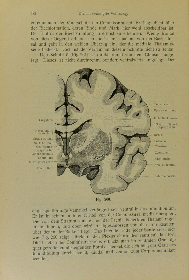 erkennt man den Querschnitt der Commissura ant. Er liegt dicht über der Riechformation, deren Rinde und Mark hier wohl abscbeidbar ist. Der Eintritt der Riechstrahlung in sie ist zu erkennen. Wenig frontal von dieser Gegend erhebt sich die Taenia thalami von der Basis dor- sal und geht in den weißen Überzug ein, der die mediale Thalamus- seite bedeckt. Doch ist der Verlauf an diesem Schnitte nicht zu sehen. Den Schnitt 5 (Fig 261) ist direkt frontal von dem Chiasma ange- legt. Dieses ist nicht durchtrennt, sondern ventralwärts umgelegt. Der Cingijlum. Plexus chor. i ventr. lat. | Nucl. ant. tlial. Nucl. lat. thal. Col. fornicis. Capsula int. Globus pallidus. Comm. ant. Subst. grisea centr. Tract. olfact. Fas. arccuat. Gyrus centr. ant. Fußd.Stabkranzes. IG eg. d. Hypogl. ju. Sprachbann. Insula. Putamen. Claustrum. Comm. ant. Fase, uncin. Area olfactoria. Lob. temporalis. Fig. 260. enge spaltförmige Ventrikel verlängert sich ventral in das Infundibulum. Er ist in seinem unteren Drittel von der Commissu ra media überquert. Die von dem Stratum zonale und der Taenia bedeckten Thalami ragen in ihn hinein, und oben wird er abgeschlossen von den Fornixsäulen, über denen der Balken liegt. Das laterale Ende jeder Säule setzt sich wie Fig. 260 zeigt, direkt in den Plexus chorioides ventneuh lat. fort. Dicht neben der Commisura mollis erblickt man im zentralen Grau d^e quer getroffenen absteigenden Fornixschenkel, die sich hier, das Grau des Infundibulum durchsetzend, kaudal und ventral zum Corpus mamillare wenden.