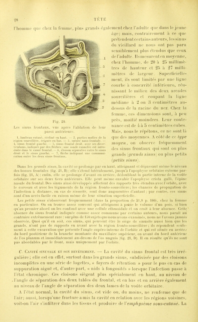 l’homme que chez la femme, plus grands également chez l’adulte que dans le jeune âge; mais, contrairement à ce que p r é t e n d e n t c e r t a i n s a u t e u r s, 1 e s s i n u s du vieillard ne nous ont pas paru sensiblement plus étendus que ceux del’adulte. Ils mesurent en moyenne, chez l’homme, de 20 à 25 millimè- tres de hauteur et 25 à 27 milli- mètres de largeur. Superficielle- ment. ils sont limités par une ligne courbe à concavité inférieure*, réu- nissant le milieu des deux arcades sourcilières et coupant la ligne médiane à 2 ou 5 centimètres au- dessus de la racine du nez. Chez la femme, ces dimensions sont, à peu près, moitié moindres. Leur conte- nance est de 4 à 5 centimètres cubes. Mais, nous le répétons, ce ne sont là que des moyennes. A côté de ce type moyen, on observe fréquemment des sinus frontaux qui sont ou plus grands (grands sinus) ou plus petits (petits sinus). Dans les grands sinus, la cavité se prolonge par en haut, atteignant et dépassant même le niveau des bosses frontales (lig. 21, B) ; elle s'étend latéralement, jusqu'à l’apophyse orbitaire externe par- fois (fîg. 21, A) ; enfin, elle se prolonge d’avant en arrière, dédoublant la partie interne de la voûte orbitaire sur ses deux tiers antérieurs. Elle peut même envahir l’apophyse crista galli, l’épine nasale du frontal. Des sinus ainsi développés atfectent des rapports très étendus avec l'orbite, avec le cerveau et avec les téguments de la région fronto-sourcilière; les chances de propagation de l'infection à distance, en cas de sinusite, sont donc augmentées d’autant ; par contre, ces sinus sont d’un accès facile en raison même de leur situation superficielle, Les petits sinus s’observent fréquemment (dans la proportion de 31,8 p. 100), chez la femme en particulier. On en trouve assez souvent qui atteignent à peine le volume d’un pois, si bien qu’au premier abord on les confond avec une cellule ethmoïdale et on croit à leur absence. CeLte absence du sinus frontal indiquée comme assez commune par certains auteurs, nous paraît au contraire extrêmement rare : surplus de 130 sujets que nous avons examinés, nous ne l'avons jamais observée. Quoi qu’il en soit, ces sinus, qui peuvent être le siège de sinusite aussi bien que les grands, n’ont pas de rapports en avant avec la région fronto-sourcilière ; ils répondent seule- ment à cette excavation que présente l’angle supéro-interne de l’orbite et qui est située en arrière du bord postérieur de la branche montante du maxillaire supérieur, en avant du bord antérieur de l’os planum et immédiatement au-dessus de l’os unguis (lig. 21, D). Il en résulte qu’ils ne sont pas abordables par le front, mais uniquement par l’orbite. C Cavité sinusale et son revêtement. — La cavité du sinus frontal est très irré- gulière ; elle est en effet, surtout dans les grands sinus, subdivisée par des cloisons incomplètes en une série de logettes, « foyers de rétention » pour le pus en cas de suppuration aiguë et, d’autre part, « nids à fongosités n lorsque l’infection passe à l’état chronique. Ces cloisons siègent plus spécialement en haut, au niveau de l’angle de séparation des deux tables du frontal, et en bas et en arrière également au niveau de l’angle de séparation des deux lames de la voûte orbitaire. A l’état normal, la cavité du sinus, est vide ou, du moins, ne renferme que de l'air; aussi, lorsqu’une fracture amis la cavité en relation avec les régions voisines, voit-on l’air s’infiltrer dans les tissus et produire de Y emphysème sous-cutané. La Fig. 20. Les sinus frontaux, vus après l'ablation de leur paroi antérieure. 1, lambeau cutané, récliné en haut. — 2. parties molles (le la région sourcilière, érignée en bas. — 3. suture naso-lronlale. — 4, sinus frontal gauebe. — 5, sinus frontal droit, avec ses diver- liculums, indiqués par des flèches ; une sonde cannelée est intro- duite dans le canal frontal. — 6, cloison séparative entre le sinus droit et le sinus gauche. — 7, flèche indiquant une communi- cation entre les deux sinus frontaux.