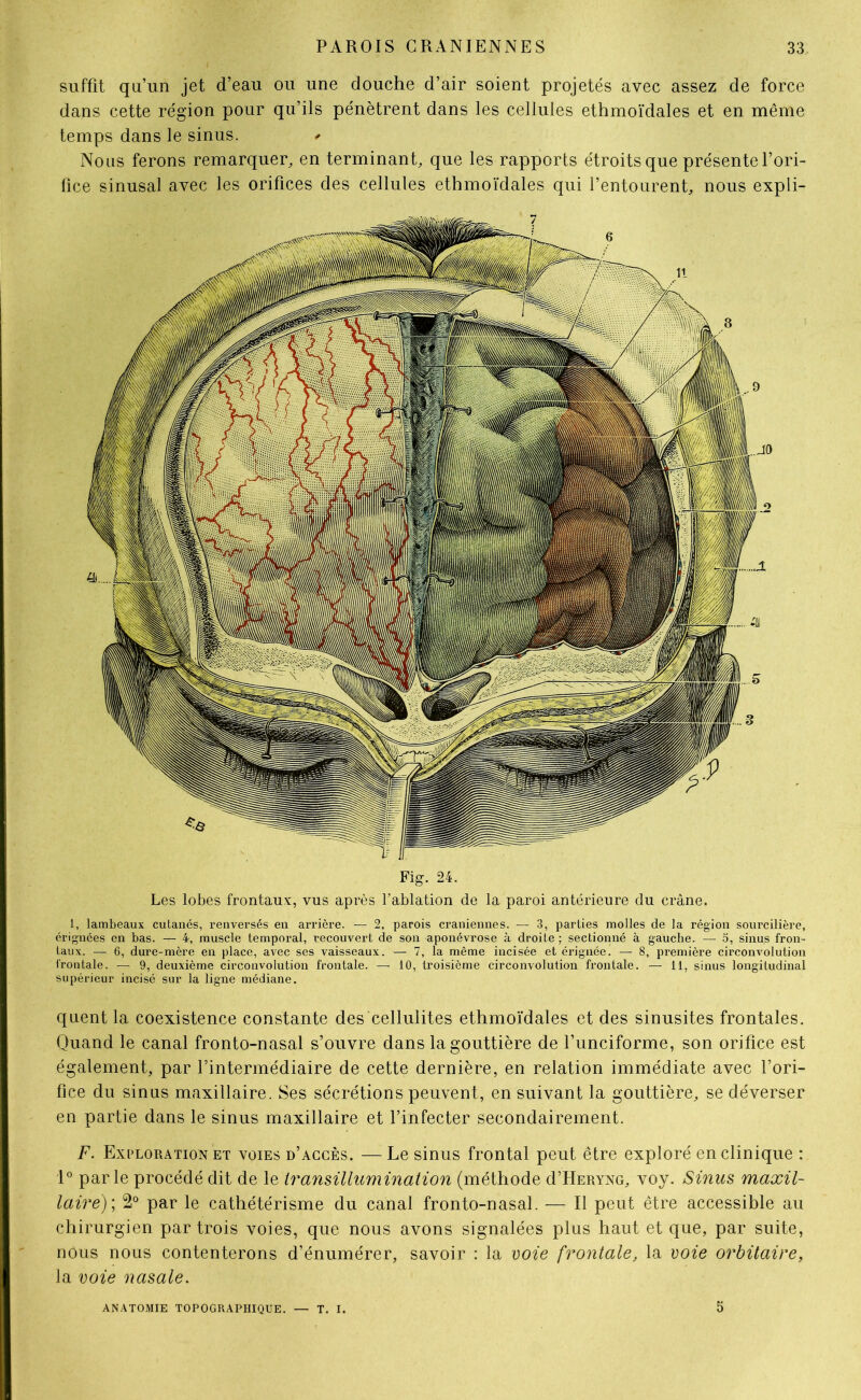 suffit qu’un jet d’eau ou une douche d’air soient projetés avec assez de force dans cette région pour qu’ils pénètrent dans les cellules ethmoïdales et en même temps dans le sinus. * Nous ferons remarquer, en terminant, que les rapports étroits que présente l’ori- fice sinusal avec les orifices des cellules ethmoïdales qui l’entourent, nous expli- Fig. 24. Les lobes frontaux, vus après l’ablation de la paroi antérieure du crâne. 1, lambeaux cutanés, renversés en arrière. — 2, parois crâniennes. — 3, parties molles de la région sourcilière, érignées en bas. — 4, muscle temporal, recouvert de son aponévrose à droite ; sectionné à gauche. — 5, sinus fron- taux. — 6, dure-mère en place, avec ses vaisseaux. — 7, la même incisée et érignée. — 8, première circonvolution frontale. — 9, deuxième circonvolution frontale. —• 10, troisième circonvolution frontale. — 11, sinus longitudinal supérieur incisé sur la ligne médiane. quent la coexistence constante des cellulites ethmoïdales et des sinusites frontales. Quand le canal fronto-nasal s’ouvre dans la gouttière de funciforme, son orifice est également, par l’intermédiaire de cette dernière, en relation immédiate avec l’ori- fice du sinus maxillaire. Ses sécrétions peuvent, en suivant la gouttière, se déverser en partie dans le sinus maxillaire et l’infecter secondairement. F. Exploration et voies d’accès. — Le sinus frontal peut être exploré en clinique : 1° parle procédé dit de le iransülumination (méthode d’HERYNG, voy. Sinus maxil- laire); 2° par le cathétérisme du canal fronto-nasal. -— Il peut être accessible au chirurgien par trois voies, que nous avons signalées plus haut et que, par suite, nous nous contenterons d’énumérer, savoir : la voie frontale, la voie orbitaire, la voie nasale. ANATOMIE TOPOGRAPHIQUE. — T. I. 5