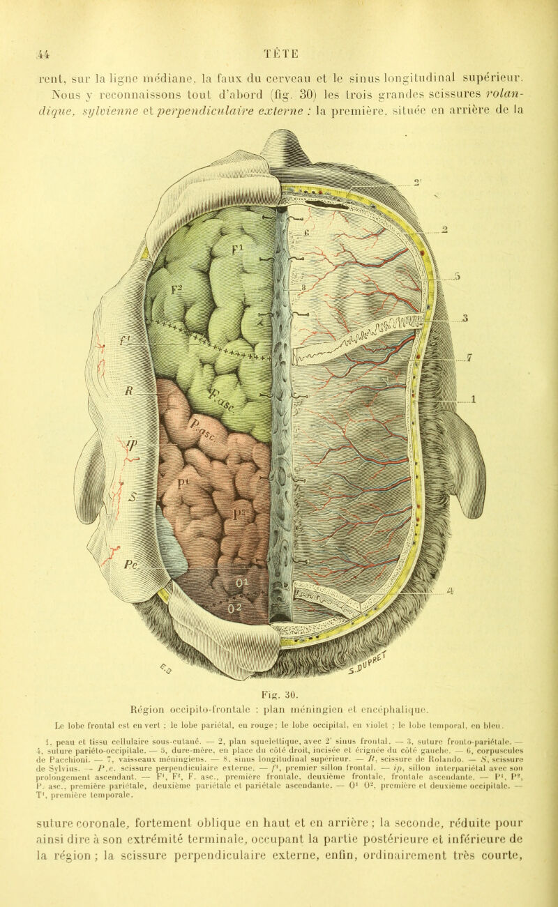 rent, sur la ligne médiane,, la faux du cerveau et le sinus longitudinal supérieur. Nous y reconnaissons tout d’abord (fig. 30) les trois grandes scissures rolan- dique, siyluienne et perpendiculaire externe : la première, située en arrière de la Fig. 30. Région occipito-frontale : plan méningien et encéphalique. Le lobe frontal est en vert ; le lobe pariétal, en rouge; le lobe occipital, en violet ; le lobe temporal, en bleu. 1. peau et tissu cellulaire sous-cutané. — 2, plan squelettique, avec 2’ sinus frontal. — 3, suture fronto-pariétalc. — 4, suture pariéto-occipitale. — S, dure-mère, en place du côté droit, incisée et érignée du côté gauche. — G, corpuscules de Pacchioni. — 7, vaisseaux méningiens. — 8, sinus longitudinal supérieur. — B, scissure de Rolando. — .S’, scissure de Sylvius. — P.e. scissure perpendiculaire externe. — /'*, premier sillon frontal. — ip, sillon interpariétal avec son prolongement ascendant. — F1, F2, F. asc., première frontale, deuxième frontale, frontale ascendante. — F1, V-, P. asc., première pariétale, deuxième pariétale et pariétale ascendante. — O1 O2, première et deuxième occipitale. — T1, première temporale. suturecoronale, fortement oblique en haut et en arrière; la seconde, réduite pour ainsi dire à son extrémité terminale, occupant la partie postérieure et inférieure de la région ; la scissure perpendiculaire externe, enfin, ordinairement très courte,