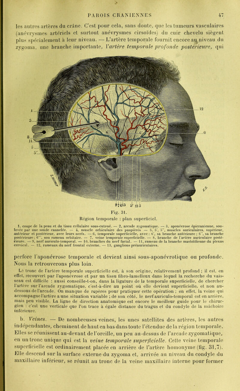les autres artères du crâne. C’est pour cela, sans doute, que les tumeurs vasculaires (anévrysmes artériels et surtout anévrysmes cirsoïdes) du cuir chevelu siègent plus spécialement à leur niveau. — L’artère temporale fournit encore au niveau du zygoma, une branche importante, Y artère temporale profonde postérieure, qui Fig. 3t. Région temporale : plan superficiel. 1, coupe de la peau et du tissu cellulaire sous-cutpné. — 2, arcade zygomatique. — 3, aponévrose épicranienne, sou- levée par une sonde cannelée. — 4, muscle orbiculaire des paupières — 5, 5’, 5”, muscles auriculaires, supérieur, antérieur et postérieur, avec leurs nerfs. —6, temporale superficielle, avec : 6', sa branche antérieure ; 6 ’, sa branche postérieure; 6”’, son rameau orbitaire. — 7, veine temporale superficielle. — 8, branche de l'artère auriculaire posté- rieure. — 9, nerf auriculo-temporal. — 10, branches du nerf facial. — 11, rameau de la branche mastoïdienne du plexus cervical. — 12, rameaux du nerf frontal externe. — 13, ganglions préauriculaires. perfore l’aponévrose temporale et devient ainsi sous-aponévrotique ou profonde. Nous la retrouverons plus loin. Lé tronc de l’artère temporale superficielle est, à son origine, relativement profond ; il est, en effet, recouvert par l’aponévrose et par un tissu fibro-lamelleux dans lequel la recherche du vais- seau est difficile : aussi conseille-t-on, dans la ligature de la temporale superficielle, de chercher l’artère sur l’arcade zygomatique, c’est-à-dire au point où elle devient superficielle, et non au- dessous de l’arcade. On manque de repères pour pratiquer cette opération ; en effet, la veine qui accompagne l’artère aune situation variable ; de son côté, le nerf auriculo-temporal est en arrière, mais peu visible. La ligne de direction anatomique est encore le meilleur guide pour le chirur- gien : c’est une verticale que l’on trace à égale distance du tragus et du condyle de la mâchoire inférieure. b. Veines. — De nombreuses veines, les unes satellites des artères, les autres indépendantes, cheminent de haut en bas dans toute l’étendue de la région temporale. Elles se réunissent au-devant de l’oreille, un peu au-dessus de l’arcade zygomatique, en un tronc unique qui est la veine temporale superficielle. Cette veine temporale superficielle est ordinairement placée en arrière de l’artère homonyme (fig. 31,7). Elle descend sur la surface externe du zygoma et, arrivée au niveau du condyle du maxillaire inférieur, se réunit au tronc de la veine maxillaire interne pour former