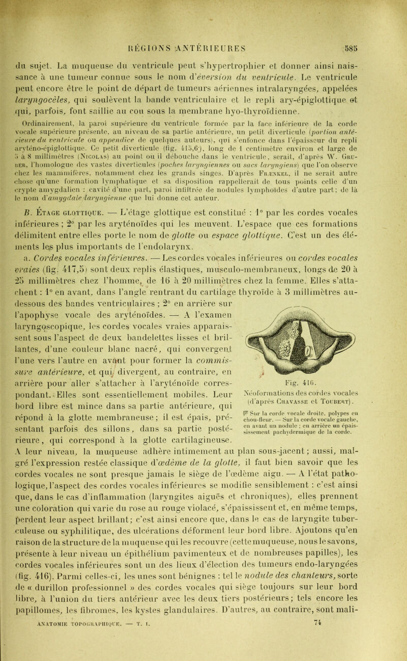 du sujet. La muqueuse du ventricule peut s’hypertrophier et donner ainsi nais- sance à une tumeur connue sous le nom d’éversion du ventricule. Le ventricule peut encore être le point de départ de tumeurs aériennes intralaryngées, appelées laryngôcèles, qui soulèvent la bande ventriculaire et le repli ary-épiglottique et qui, parfois, font saillie au cou sous la membrane hyo-thyroïdienne. Ordinairement, la paroi supérieure du ventricule formée par la face inférieure de la corde vocale supérieure présente, au niveau de sa partie antérieure, un petit diverticule (portion anté- rieure du ventricule on appendice de quelques auteurs), qui s’enfonce dans l’épaisseur du repli arvténo-épiglottique. Ce petit diverticule (fig. 41o,6j, long de 1 centimètre environ et large de .') à 8 millimètres (Nicolas) au point ou il débouche dans le ventricule, serait, d’après W. Gru- i>ER, l’homologue des vastes diverticules (poches laryngiennes ou sacs laryngiens) que l’on observe chez les mammifères, notamment chez les grands singes. D’après Frænkel. il ne serait autre chose qu'une formation lymphatique et sa disposition rappellerait de tous points celle d’un crypte amygdalicn : cavité d’une part, paroi infiltrée de nodules lymphoïdes d’autre part; de là le nom d'amygdale laryngienne que lui donne cet auteur. B. Étage glottique. — L’étage glottique est constitué : 1° par les cordes vocales inférieures ; 2° par les aryténoïdes qui les meuvent. L’espace que ces formations délimitent entre elles porte le nom dq glotte ou espace glottique. C’est un des élé- ments les plus importants de l’endolarynx. a. Cordes vocales inférieures. —Les cordes vocales inférieures ou cordes vocales vraies (fig. 417,5) sont deux replis élastiques, musculo-membraneux, longs de 20 à 25 millimètres chez l’homme, de 16 à 20 millimètres chez la femme. Elles s’atta- chent : 1° en avant, dans l’angle rentrant du cartilage thyroïde à 3 millimètres au- dessous des bandes ventriculaires ; 2° en arrière sur l’apophyse vocale des aryténoïdes. — A l’examen laryngoscopique, les cordes vocales vraies apparais- sent sous l’aspect de deux bandelettes lisses et bril- lantes, d’une couleur blanc nacré, qui convergeât l’une vers l’autre en avant pour former la commis- sure antérieure. et qui/ divergent, au contraire, en arrière pour aller s’attacher à l’aryténoïde corres- pondant. Elles sont essentiellement mobiles. Leur bord libre est mince dans sa partie antérieure, qui répond à la glotte membraneuse ; il est épais, pré- sentant parfois des sillons, dans sa partie posté- rieure, qui correspond à la glotte cartilagineuse. A leur niveau, la muqueuse adhère intimement au plan sous-jacent ; aussi, mal- gré l’expression restée classique d’œdème de la glotte, il faut bien savoir que les cordes vocales ne sont presque jamais le siège de l’œdème aigu. — A l’état patho- logique, l’aspect des cordes vocales inférieures se modifie sensiblement : c’est ainsi que, dans le cas d’inflammation (laryngites aiguës et chroniques), elles prennent une coloration qui varie du rose au rouge violacé, s’épaississent et, en même temps, perdent leur aspect brillant; c’est ainsi encore que, dans le cas de laryngite tuber- culeuse ou syphilitique, des ulcérations déforment leur bord libre. Ajoutons qu’en raison de la structure de la muqueuse qui les recouvre (cette muqueuse, nous le savons, présente à leur niveau un épithélium pavimenteux et de nombreuses papilles), les cordes vocales inférieures sont un des lieux d’élection des tumeurs endo-laryngées (fig. 416). Parmi celles-ci, les unes sont bénignes : tel le nodule des chanteurs, sorte de « durillon professionnel » des cordes vocales qui siège toujours sur leur bord libre, à l’union du tiers antérieur avec les deux tiers postérieurs; tels encore les papillomes, les fibromes, les kystes glandulaires. D’autres, au contraire, sont mali- 74 Néoformations des cordes vocales (cl après Chavasse et Toubert). F Sur la corde vocale droilc, polypes en chou-fleur. — Sur la corde vocale gauche, en avant un nodule ; en arrière un épais- sissement pachydermique de la corde. ANATOMIE TOPOGRAl'HIQCE. T. I.