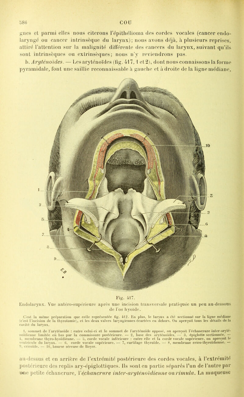 gnes et parmi elles nous citerons l’épithélioma des cordes vocales (cancer endo- laryngé ou cancer intrinsèque du larynx); nous avons déjà, à plusieurs reprises, attiré l’attention sur la malignité différente des cancers du larynx, suivant qu’ils sont intrinsèques ou extrinsèques; nous n’y reviendrons pas. b. Aryténoïdes. — Les aryténoïdes (fig. 417,1 et 2), dont nous connaissons la forme pyramidale, font une saillie reconnaissable à gauche et à droite de la ligne médiane. Fig. 417. Endolarynx. Vue antéro-supérieure après une incision transversale pratiquée un peu au-dessous de l’os hyoïde. C'esl la même préparation que celle représentée fig. 412. En plus, le larynx a été sectionné sur la ligne médiane (c’est l’incision de la thyrotomie), et les deux valves laryngiennes écartées en dehors. On aperçoit tous les délails de la cavité du larynx. 1, sommet de l’aryténoïde : entre celui-ci et le sommet de l’aryténoïde opposé, on aperçoit l’échancrure inter-aryté- noïdienne limitée en bas par la commissure postérieure. — 2, base des aryténoïdes. — 3, épiglotte sectionnée. — 4, membrane thyro-hyoïdienne. — 5, corde vocale inférieure : entre elle et la corde vocale supérieure, on aperçoit le ventricule du larynx. — 6, corde vocale supérieure. — 7, cartilage thyroïde. — 8, membrane crico-thyroïdienne. — 9, cricoïde. — 10, bourse séreuse de Boyer. au-dessus et en arrière de l’extrémité postérieure des cordes vocales, à l’extrémité postérieure des replis ary-épiglottiques. Ils sont en partie séparés l’un de l’autre par une petite échancrure, Y échancrure inter-aryténoïdienne owrimula. La muqueuse