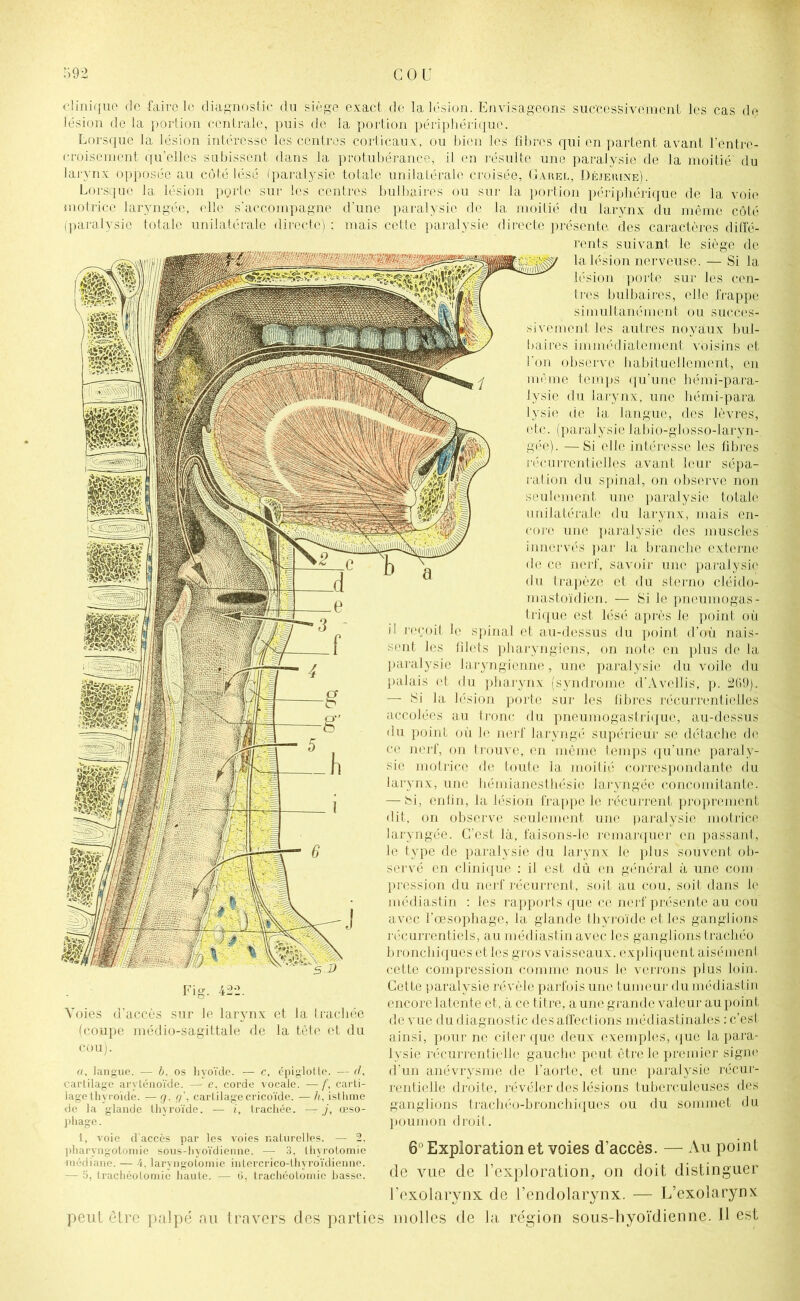 clinique do faire le diagnostic du siège exact de la lésion. Envisageons successivement les cas de lésion de la portion centrale, puis de la portion périphérique. Lorsque la lésion intéresse les centres corticaux, ou bien les fibres qui en partent avant l'entre- croisement qu’elles subissent dans la protubérance, il en résulte une paralysie de la moitié du larynx opposée au côté lésé (paralysie totale unilatérale croisée, Garel, Déjeiune). Lorsque la lésion porte sur les centres bulbaires ou sur la portion périphérique de la voie motrice laryngée, elle s'accompagne d'une paralysie de la moitié du larynx du même côté (paralysie totale unilatérale directe) : mais cette paralysie directe présente des caractères diffé- rents suivant le siège de la lésion nerveuse. — Si la lésion porte sur les cen- tres bulbaires, elle frappe simultanément ou succes- sivement les autres noyaux bul- baires immédiatement voisins et l'on observe habituellement, en même temps qu’une hémi-para- lysie du larynx, une hémi-para lysie de la langue, des lèvres, etc. (paralysie labio-glosso-larjm- gée). — Si elle intéresse les fibres récurrentielles avant leur sépa- ition du spinal, on observe non seulement une paralysie totale unilatérale du larynx, mais en- core une paralysie des muscles innervés par la branche externe de ce nerf, savoir une paralysie du trapèze et du sterno cléido- mastoïdien. — Si le pneumogas- trique est lésé après le point où il reçoit le spinal et au-dessus du point d’où nais- sent les filets pharyngiens, on note en plus de la paralysie laryngienne, une paralysie du voile du palais et du pharynx (syndrome d’Avellis, p. 269). — Si la lésion porte sur les fibres récurrentielles accolées au tronc du pneumogastrique, au-dessus du point où le nerf laryngé supérieur se détache de ce nerf, on trouve, en même temps qu’une paraly- sie motrice de toute la moitié correspondante du larynx, une hémianesthésie laryngée concomitante. — Si, enfin, la lésion frappe le récurrent proprement dit, on observe seulement une paralysie motrice laryngée. C’est là, faisons-lc remarquer en passant, le type de paralysie du larynx le plus 'souvent ob- servé en clinique : il est dû en général à une com pression du nerf récurrent, soit au cou, soit dans le médiastin : les rapports que ce nerf présente au cou avec l’œsophage, la glande thyroïde et les ganglions récurrentiels, au médiastin avec les ganglions trachéo bronchiques et les gros vaisseaux, expliquent aisément cette compression comme nous le verrons plus loin. Cette paralysie révèle parfois une tumeur du médiastin encore latente et, à ce titre, aune grande valeur au point de vue du diagnostic des affections médiastinales : c’est ainsi, pour ne citer que deux exemples, que la para- lysie récurrentielle gauche peut être le premier signe d’un anévrysme de l’aorte, et une paralysie récur- rentielle droite, révéler des lésions tuberculeuses des ganglions trachéo-bronchiques ou du sommet du poumon droit. Voies d’accès sur le larynx et la trachée (coupe médio-sagittale de la tête et du cou). «, langue. — 6, os hyoïde. — c, épiglotte. — d, earlilage aryténoïde. — e. corde vocale. — /', carti- lage thyroïde. — g. g1, cartilagecricoïde. — h, isthme de la glande thyroïde. — i, trachée. — j, œso- phage. 1, voie d’accès par les voies naturelles. — 2, pharyngotomie sous-hyoïdienne. — 3, thyrotomie médiane. — 4, laryngotomie intercrico-thvroïdienne. — 5, trachéotomie haute. — ü, trachéotomie basse. 6° Exploration et voies d’accès. — Au point de vue de l’exploration, on doit distinguer l’exolarynx de l’endolarynx. — L’exolarynx; peut être palpé au travers des parties molles de la région sous-hyoïdienne. 11 est