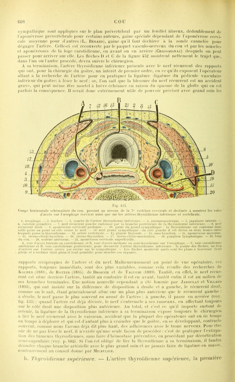 sympathique sont appliqués sur le plan prévertébral par un feuillet übreux, dédoublement de l’aponévrose prévertébrale pour certains auteurs, gaine spéciale dépendant de l’aponévrose cervi- cale moyenne pour d'autres (L. Békard), gaine qu’il faut déchirer à la sonde cannelée pour dégager l'artère. Celle-ci est recouverte par le paquet vasculo-nerveux du cou et par les muscles et aponévroses de la loge carotidienne, en avant ou en arrière (Chassaignac) desquels on peul passer pour arriver sur elle. Les flèches D et C de la figure 482 montrent nettement le trajet que, dans l'un ou l’autre procédé, devra suivre le chirurgien. A sa terminaison, l'artère thySdienne inférieure présente avec le nerf récurrent des rapports qui ont, pour la chirurgie du goitre, un intérêt de premier ordre, en ce qu'ils exposent l’opérateur allant à la recherche de l'artère pour en pratiquer la ligature (ligature du pédicule vasculaire inférieur du goitre) à léser le nerf ; or, l’on sait que la blessure du nerf récurrent est un accident grave, qui peut même être mortel à brève échéance en raison du spasme de la glotte qui en est, parfois la conséquence. Il serait donc extrêmement utile de pouvoir préciser avec grand soin les Fig. 432. jjgSr _û t Coupe horizontale schématisée du cou, passant au niveau de la 7° vertèbre cervicale et destinée à montrer les voies d'accès sur l'œsophage cervical ainsi que sur les artères thyroïdienne inférieure et vertébrale. 1, œsophage. — 2. trachée. — 3, courbe de l’artère thyroïdienne inférieure. — V. pneumogastrique. — b, jugulaire interne. — 6, carotide primitive. — 7, nerf récurrent gauche embrassé par la branche postérieure de la thyroïdienne inférieure. — 8, nerf récurrent droit. — 9, aponévrose cervicale profonde. — 10. gaine du grand sympathique : la thyroïdienne est contenue dans cette gaine au point où elle croise le nerf. — JO’ nerf grand sympathique : du côté gauche il est divisé en deux troncs entre lesquels passe la thyroïdienne.— 11, artère vertébrale.— 12, glande thyroïde. — 13. omo-hyoïdien. —14, aponévrose moyenne. — 15, sterno-cléido-hyoïdien. — 16, sterno-thyroïdien. — 17. sterno-cléido-mastoïdien. — 18, ganglion lymphatique. — 19, long- du cou. — 20, scalène antérieur. — 21, aponévrose cervicale superficielle. A, voie d’accès latérale ou carotidienne, et B, voie d’accès médiane ou sous-hyoïdienne sur l’œsophage. — G, voie carotidienne antérieure et D, voie carotidienne postérieure, pour découvrir l'artère thyroïdienne inférieure : la pointe des flèches, au lieu d'arriver sur l'artère, arrive par erreur sur le sympathique. — Les flèches montrent quels sont les plans à traverser (Irait pleini et à récliner (trait plein et trait pointillé) pour aborder ces organes. rapports réciproques de l’artère et du nerf. Malheureusement au point de vue opératoire, ces rapports, toujours immédiats, sont des plus variables, comme cela résulte des recherches de Kocher (1888), de Botter (1885). de Drobnik et de Taguchi (1889). Tantôt, en effet, le nerf récur- rent est situé derrière l’artère, tantôt au contraire il est en avant, tantôt enfin il est au milieu de ses branches terminales. Une notion nouvelle cependant a été fournie par Jaboulay et Yilbard (1893), qui ont insisté sur la différence de disposition à droite et à gauche, le récurrent droit, comme on le sait, étant généralement situé sur un plan plus antérieur que le récurrent gauche : à droite, le nerf passe le plus souvent en avant de l’artère; à gauche, il passe en arrière (voy. fîg. 433) ; quand l’artère est déjà divisée, le nerf s’entremêle à ses rameaux, en affectant toujours sur le côté droit une disposition plus antérieure. Au total, et c’est ce qu'il importe surtout de retenir, la ligature de la thyroïdienne inférieure à sa terminaison expose toujours le chirurgien à lier le nerf récurrent avec le vaisseau, accident que la plupart des opérateurs ont eu de temps en temps à déplorer et qui est d’autant plus à craindre que le goitre, en se développant, contracte souvent, comme nous l’avons déjà dit plus haut, des adhérences avec le tronc nerveux. Pour être sûr de ne pas léser le nerf, il n’existe qu’une seule façon de procéder : c’est de pratiquer l’extirpa- tion des tumeurs thyroïdiennes, sans faire d’hémostase préventive, en procédant par décortication sous-capsulaire (voy. p. 602). Si l’on est obligé de lier la thyroïdienne à sa terminaison, il faudra dénuder chaque branche artérielle avec le plus grand soin et ne jamais faire de ligature en masse, contrairement au conseil donné par Mickulicz. b. Thyroïdienne supérieure. — L’artère thyroïdienne supérieure, la première