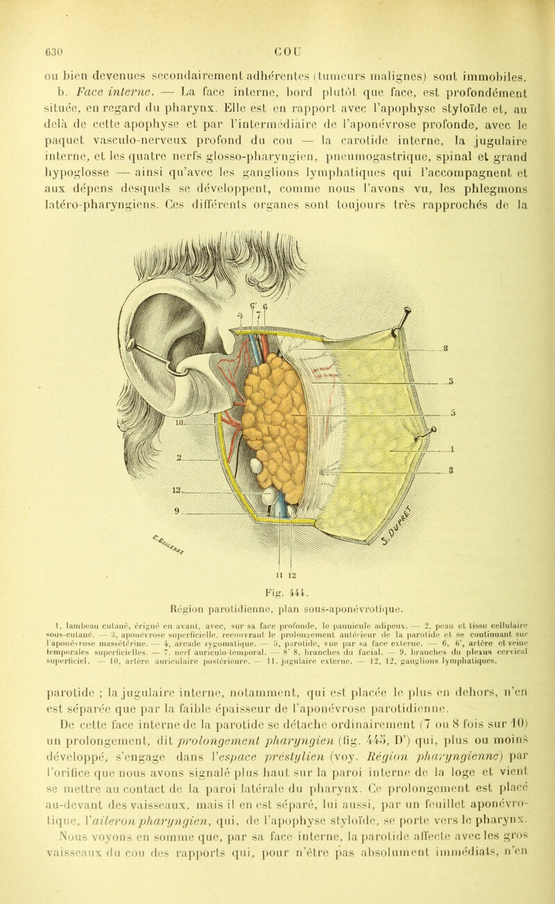 ou bien devenues secondairement adhérentes (tumeurs malignes) sont immobiles. b. Face interne. — La face interne, bord plutôt que face, est profondément située, en regard du pharynx. Elle est en rapport avec l’apophyse styloïde et, au delà de cette apophyse et par l’intermédiaire de l’aponévrose profonde, avec le paquet vasculo-nerveux profond du cou — la carotide interne, la jugulaire interne, et les quatre nerfs glosso-pharyngien, pneumogastrique, spinal et grand hypoglosse — ainsi qu’avec les ganglions lymphatiques qui l’accompagnent et aux dépens desquels se développent, comme nous l’avons vu, les phlegmons latéro-pharyngiens. Ces différents organes sont toujours très rapprochés de la Il 12 Fig. 444. Région parotidienne, plan sous-aponévrotique. 1, lambeau culané, érigné en avant, avec, sur sa face profonde, le pannicule adipeux. — 2, peau et tissu cellulaire sous-cutané. — 3, aponévrose superficielle, recouvrant le prolongement antérieur de la parotide et se continuant sur l’aponévrose massétérine. — 4, arcade zygomatique. — 5, parotide, vue par sa face externe. — 6, 6’, artère et veine temporales superficielles. — 7. nerf auriculo-lemporal. — 8’ 8, branches du facial. — 9, branches du plexus cervical superficiel. — 10, artère auriculaire postérieure. — il, jugulaire externe. — 12, 12, ganglions lymphatiques. parotide ; la jugulaire interne, notamment, qui est placée le plus en dehors, n’en est séparée que par la faible épaisseur de l’aponévrose parotidienne. De cette face interne de la parotide se détache ordinairement (7 ou 8 fois sur 10) un prolongement, dit prolongement pharyngien (fig. 445, D’) qui, plus ou moires développé, s’engage dans l'espace préstylien (voy. Région pharyngienne) par l’orifice que nous avons signalé plus haut sur la paroi interne de la loge et vient se mettre au contact de la paroi latérale du pharynx. Ce prolongement est placé au-devant des vaisseaux, mais il en est séparé, lui aussi, par un feuillet aponévro- tique, Y aileron pharyngien, qui, de l’apophyse styloïde, se porte vers le pharynx. Nous voyons en somme que, par sa face interne, la parotide affecte avec les gros vaisseaux du cou des rapports qui, pour n’être pas absolument immédiats, n’en