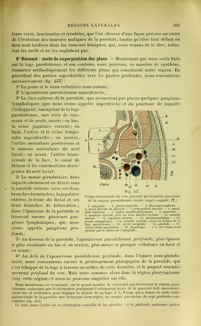 leurs vives, lancinantes et irradiées, que l’on observe d’une façon précoce au cours de l’évolution des tumeurs malignes de la parotide, tandis qu’elles font défaut ou bien sont tardives dans les tumeurs bénignes, qui, nous venons de le dire, refou- lent les nerfs et ne les. englobent pas. 6° Résumé : mode de superposition des plans. :—Maintenant que nous voilà fixés sur la loge parotidienne et son contenu, nous pouvons, en manière de synthèse, énumérer méthodiquement les différents plans qui constituent notre région. En procédant des parties superficielles vers les parties profondes, nous rencontrons successivement (fîg. 44o) : 1° La peau et le tissu cellulaire sous-cutané ; 2° L’aponévrose parotidienne superficielle ; 3° La face externe de la parotide, que recouvrent par places quelques ganglions lymphatiques (que nous avons appelés superficiels) et du pourtour de laquelle s’échappent, émergeant de la loge parotidienne, une série de vais- seaux et de nerfs, savoir : en bas, la veine jugulaire externe; en haut, l’artère et la veine tempo- rales superficielles ; en arrière, l’artère auriculaire postérieure et le rameau auriculaire du nerf facial ; en avant, l’artère trans- versale de la face, le canal de Sténon et les ramifications diver- gentes du nerf facial ; 4° La masse glandulaire, dans laquelle cheminent en divers sens la carotide externe (avec ses deux branches terminales), la jugulaire externe, le tronc du facial et ses deux branches de bifurcation ; dans l’épaisseur de la parotide se trouvent encore plusieurs gan- glions lymphatiques, que nous avons appelés ganglions pro- fonds; 5° Au-dessous de la parotide, Y aponévrose parotidienne profonde, plus épaisse et plus résistante en bas et en arrière, plus mince et presque celluleuse en haut et en avant; 6° Au delà de l’aponévrose parotidienne profonde, dans Y espace sous-glandu- laire, nous rencontrons encore le prolongement pharyngien de la parotide, qui s’est échappé de la loge à travers un orifice de cette dernière, et le paquet vasculo- nerveux profond du cou. Mais nous sommes alors dans la région pharyngienne (voy. cette région) et nous ne pouvons empiéter sur elle. Nous insisterons, en terminant, sur le grand nombre de vaisseaux qui traversent la région paro- tidienne, vaisseaux que le chirurgien pratiquant l’extirpation totale de la parotide doit successive- ment lier et sectionner pour dégager la glande de sa loge. J. L. Faure, qui a donné de cette extir- pation totale de la parotide une technique bien réglée, ne compte pas moins de sept pédicules vas- culaires (fîg. 443). Ce sont, dans l'ordre où ce chirurgien conseille de les aborder : 1° le pédicule antérieur (artère Fig. 447. Coupe horizontale du cou. passant par la partie moyenne de la région parotidienne droite (sujet congelé) (T.). 1, amygdale. — 2, glosso-staphylin. — 3, pharyngo-staphylin. — 4, paroi latérale du pharynx. — o. ptérygoïdicn interne! — 0, maxil- laire inférieur. — 7, espace maxillo-pharyngien. — 8, masséler. — 9, apophyse styloide, avec ses trois muscles styliens. - 10, carotide interne. — 11, jugulaire interne. — 12, pneumogastrique. — 13, grand sympathique. — 14, carotide externe, située en dedans de la loge parotidienne. — io, artère occipitale. — IG, parotide. — 17, sterno-cléido-mastoïdien. — 18, digastrique. — x x, axe transversal passant par le milieu de l’amygdale.