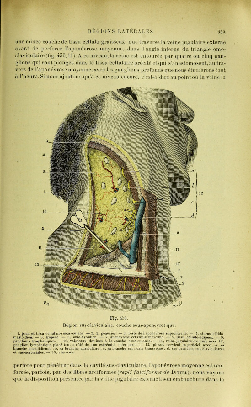 une mince couche de tissu cellulo-graisseux, que traverse la veine jugulaire externe avant de perforer l’aponévrose moyenne, dans l’angle interne du triangle omo- claviculaire(fig.4o6/ll). A ce niveau, la veine est entourée par quatre ou cinq gan- glions qui sont plongés dans le tissu cellulaire précité et qui s’anastomosent, au tra- vers de l’aponévrose moyenne, avec les ganglions profonds que nous étudierons tout à l’heure. Si nous ajoutons qu’à ce niveau encore, c’est-à-dire au point où la veine la Fig. 456. Région sus-claviculaire, couche sous-aponévrotique. i, peau et tissu cellulaire sous-cutané. — 2, 2, peaucier. — 3, reste de l’aponévrose superficielle. — 4, sterno-cléido- mastoïdien. — 5, trapèze. — 6, omo-hyoïdien. — 7, aponévrose cervicale moyenne. — 8, tissu cellulo-adipeux. — !). ganglions lymphatiques. — 10, vaisseaux destinés à la couche sous-cutanée. — 11, veine jugulaire externe, avec 11', ganglion lymphatique placé tout à côté de son extrémité inférieure. — 12, plexus cervical superficiel, avec : a. sa branche mastoïdienne ; 6, sa branche auriculaire ; c, sa branche cervicale transverse ; d, ses branches sus-claviculaires et sus-acromiales. — 13, clavicule. perfore pour pénétrer dans la cavité sus-claviculaire, l’aponévrose moyenne est ren- forcée, parfois, par des fibres arciformes (repli falciforme de Djttel), nous voyons que la disposition présentée par la veine jugulaire externe à son embouchure dans la