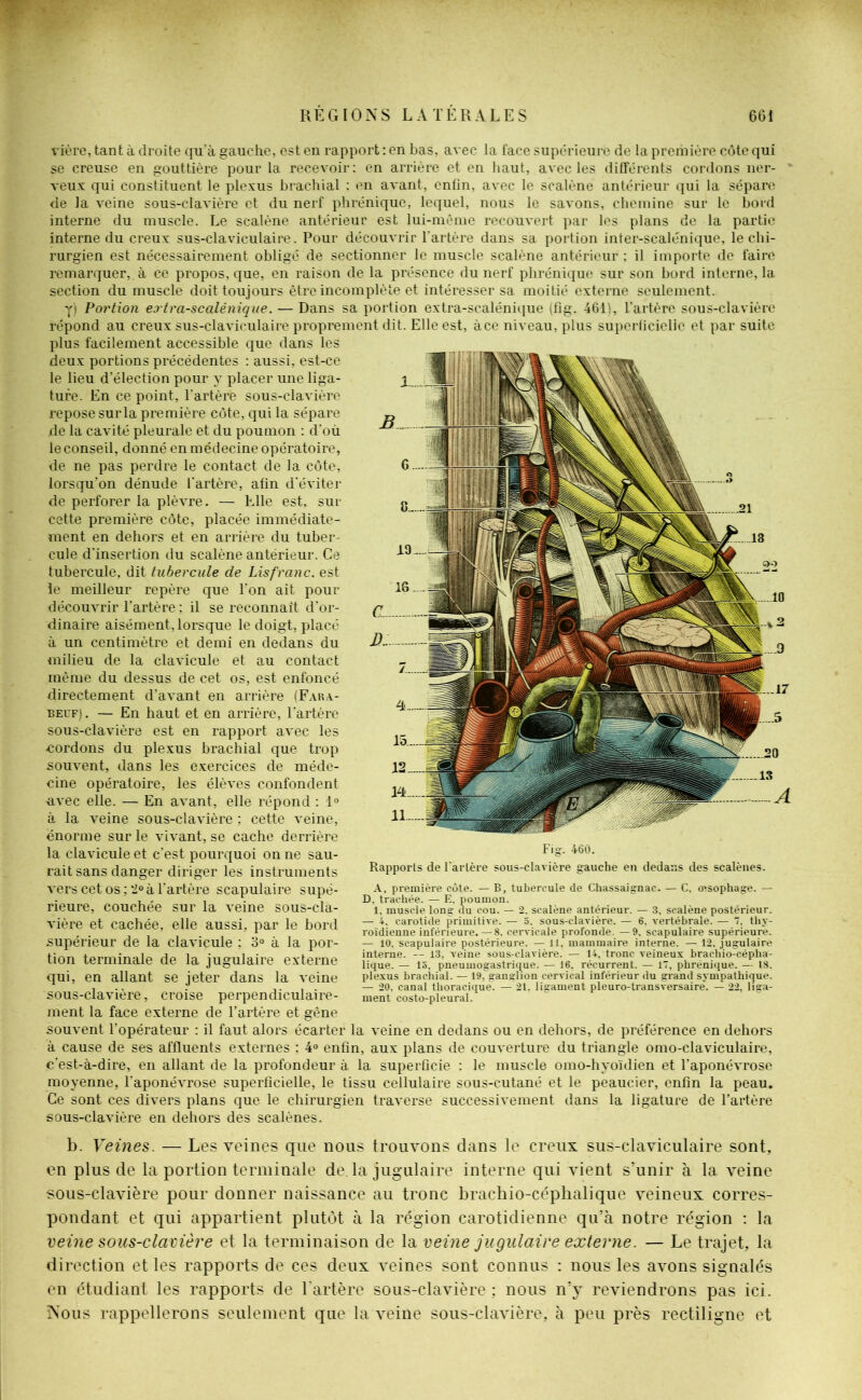vière, tant à droite qu'à gauche, est en rapport : en bas, avec la face supérieure de la première côte qui se creuse en gouttière pour la recevoir: en arrière et en haut, avec les différents cordons ner- veux qui constituent le plexus brachial : en avant, enfin, avec le scalène antérieur qui la sépare de la veine sous-clavière et du nerf phrénique, lequel, nous le savons, chemine sur le bord interne du muscle. Le scalène antérieur est lui-même recouvert par les plans de la partie interne du creux sus-claviculaire. Pour découvrir l'artère dans sa portion inter-scalénique, le chi- rurgien est nécessairement obligé de sectionner le muscle scalène antérieur : il importe de faire remarquer, à ce propos, que, en raison de la présence du nerf phrénique sur son bord interne, la section du muscle doit toujours être incomplète et intéresser sa moitié externe seulement. Y) Portion extra-scalénique. — Dans sa portion extra-scalénique (fîg. 461), l’artère sous-clavière répond au creux sus-claviculaire proprement dit. Elle est, àce niveau, plus superficielle et par suite plus facilement accessible que dans les deux portions précédentes : aussi, est-ce le lieu d’élection pour y placer une liga- ture. En ce point, l'artère sous-clavière repose sur la première côte, qui la sépare de la cavité pleurale et du poumon : d’où le conseil, donné en médecine opératoire, de ne pas perdre le contact de la côte, lorsqu’on dénude l'artère, afin d'éviter de perforer la plèvre. — Elle est, sur cette première côte, placée immédiate- ment en dehors et en arrière du tuber- cule d'insertion du scalène antérieur. Ce tubercule, dit tubercule de Lis franc, est le meilleur repère que Ton ait pour découvrir l’artère ; il se reconnaît d'or- dinaire aisément, lorsque le doigt, placé à un centimètre et demi en dedans du milieu de la clavicule et au contact même du dessus de cet os, est enfoncé directement d’avant en arrière (Faka- beuf). — En haut et en arrière, l'artère sous-clavière est en rapport avec les -cordons du plexus brachial que trop souvent, dans les exercices de méde- cine opératoire, les élèves confondent -avec elle. — En avant, elle répond : 1° à la veine sous-clavière ; cette veine, énorme sur le vivant, se cache derrière la clavicule et c'est pourquoi on ne sau- rait sans danger diriger les instruments vers cet os ; 2° à l’artère scapulaire supé- rieure, couchée sur la veine sous-cla- vière et cachée, elle aussi, par le bord supérieur de la clavicule ; 3° à la por- tion terminale de la jugulaire externe qui, en allant se jeter dans la veine sous-clavière, croise perpendiculaire- ment la face externe de l’artère et gêne souvent l’opérateur : il faut alors écarter la veine en dedans ou en dehors, de préférence en dehors à cause de ses affluents externes : 4° enfin, aux plans de couverture du triangle omo-claviculaire, c'est-à-dire, en allant de la profondeur à la superficie : le muscle omo-hyoïdien et l’aponévrose moyenne, l’aponévrose superficielle, le tissu cellulaire sous-cutané et le peaucier, enfin la peau. Ce sont ces divers plans que le chirurgien traverse successivement dans la ligature de l’artère sous-clavière en dehors des scalènes. b. Veines. — Les veines que nous trouvons dans le creux, sus-claviculaire sont, en plus de la portion terminale de. la jugulaire interne qui vient s’unir à la veine sous-clavière pour donner naissance au tronc brachio-céphalique veineux corres- pondant et qui appartient plutôt à la région carotidienne qu’à notre région : la veine sous-clavière et la terminaison de la veine jugulaire externe. — Le trajet, la direction et les rapports de ces deux veines sont connus : nous les avons signalés en étudiant les rapports de l’artère sous-clavière : nous n’y reviendrons pas ici. Nous rappellerons seulement que la veine sous-clavière, à peu près rectiligne et Fig. 460. Rapports de l'arlère sous-clavière gauche en dedans des scalènes. A, première côte. — B, tubercule de Chassaignac. — C. œsophage. — D. trachée. — E. poumon. 1. muscle long du cou. — 2. scalène antérieur. — 3. scalène postérieur. — 4. carotide primitive. — 3. sous-clavière. — 6. vertébrale. — 7. thy- roïdienne inférieure.— 8, cervicale profonde. — 9. scapulaire supérieure. — 10. scapulaire postérieure. — 11, mammaire interne. — 12. jugulaire interne. — 13, veine sous-clavière. — 14, tronc veineux brachio-cépha- lique. — 13, pneumogastrique. — 16. récurrent. — 17, phrénique. — 18. plexus brachial. — ^.ganglion cervical inférieur du grand sympathique. — 20. canal thoracique. — 21. ligament pleuro-transversaire*. — 22, liga- ment costo-pleural.