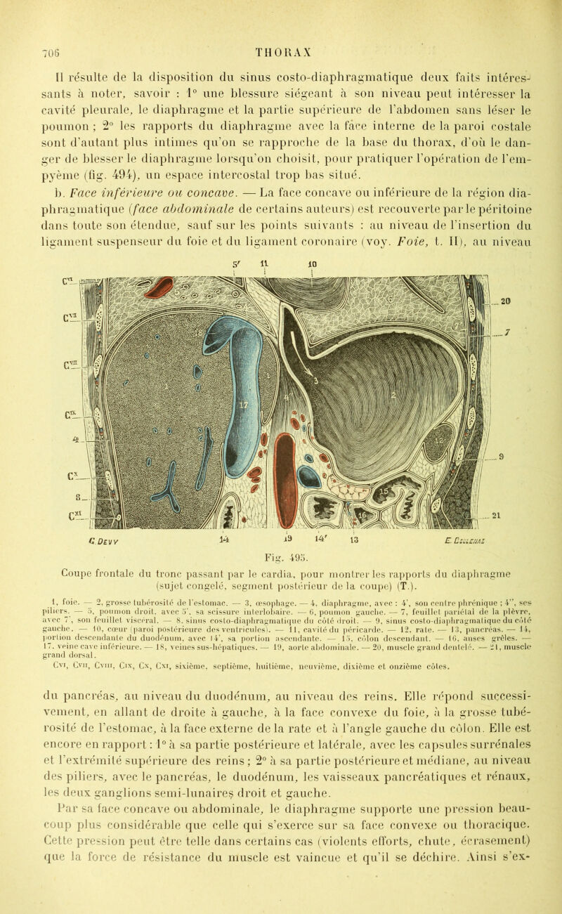 Il résulte de la disposition du sinus costo-diaphragmatique deux faits intéres- sants à noter, savoir : 1° une blessure siégeant à son niveau peut intéresser la cavité pleurale, le diaphragme et la partie supérieure de l’abdomen sans léser le poumon ; 2° les rapports du diaphragme avec la face interne de la paroi costale sont d’autant plus intimes qu’on se rapproche de la base du thorax, d’où le dan- ger de blesser le diaphragme lorsqu’on choisit, pour pratiquer l’opération de l’em- pyème (fig. 494), un espace intercostal trop bas situé. b. Face inférieure ou concave. — La face concave ou inférieure de la région dia- phragmatique (face abdominale de certains auteurs) est recouverte par le péritoine dans toute son étendue, sauf sur les points suivants : au niveau de l’insertion du ligament suspenseur du foie et du ligament coronaire (voy. Foie, t. Il), au niveau CDevy ü 14' 13 £. Dculcuaz Fig. 495. Coupe frontale du tronc passant par le cardia, pour montrer les rapports du diaphragme (sujet congelé, segment postérieur delà coupe) (T.). 1, foie. — 2, grosse tubérosité de l’estomac. — 3, œsophage. — 4, diaphragme, avec : 4’, son centre phrénique ; 4”, ses piliers. — 5, poumon droit, avec 5’, sa scissure interlobaire. — 6, poumon gauche. — 7, feuillet pariétal de la plèvre, avec 7’, son feuillet viscéral. — 8. sinus costo-diaphragmatique du côté droit. — 9, sinus costo-diaphragmatique du côté gauche. — 10, cœur (paroi postérieure des ventricules). — 11, cavité du péricarde. — 12, rate. — 13, pancréas. — 14, portion descendante du duodénum, avec 14’, sa portion ascendante. — 15, côlon descendant. — tC, anses gi'èles. — 17. veine cave inférieure. — 18, veines sus-hépatiques. — 19, aorte abdominale. — 20, muscle grand dentelé. — 21, muscle grand dorsal. Cvi, Cvii, Cvin, Cix, Cx, Cxi, sixième, septième, huitième, neuvième, dixième et onzième côtes. du pancréas, au niveau du duodénum, au niveau des reins. Elle répond successi- vement, en allant de droite à gauche, à la face convexe du foie, à la grosse tubé- rosité de l’estomac, à la face externe de la rate et à l’angle gauche du côlon. Elle est encore en rapport : 1° à sa partie postérieure et latérale, avec les capsules surrénales et l’extrémité supérieure des reins ; 2° à sa partie postérieure et médiane, au niveau des piliers, avec le pancréas, le duodénum, les vaisseaux pancréatiques et rénaux, les deux ganglions semi-lunaireç droit et gauche. Par sa face concave ou abdominale, le diaphragme supporte une pression beau- coup plus considérable que celle qui s’exerce sur sa face convexe ou thoracique. Cette pression peut être telle dans certains cas (violents efforts, chute, écrasement) que la force de résistance du muscle est vaincue et qu’il se déchire. Ainsi s’ex-