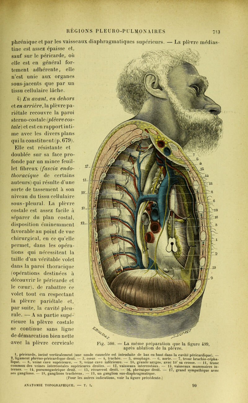 phrénique et par les vaisseaux diaphragmatiques supérieurs. — La plèvre médias- tine est assez épaisse et, sauf sur le péricarde, où elle est en général for- tement adhérente, elle n’est unie aux organes sous-jacents que par un tissu cellulaire lâche. 8) En avant, en dehors et en arrière, la plèvre pa- riétale recouvre la paroi sterno-costale (plèvre cos- tale) et est en rapport inti- me avec les divers plans qui la constituent (p. 679 ). Elle est résistante et doublée sur sa face pro- fonde par un mince feuil- let fibreux (fascia endo- thoracique de certains auteurs) qui résulte d’une sorte de tassement à son niveau du tissu cellulaire sous-pleural. La plèvre costale est assez facile à séparer du plan costal, disposition éminemment favorable au point de vue chirurgical, en ce qu’elle permet, dans les opéra- tions qui nécessitent la taille d’un véritable volet dans la paroi thoracique (opérations destinées à découvrir le péricarde et le cœur), de rabattre ce volet tout en respectant la plèvre pariétale et, par suite, la cavité pleu- rale. — A sa partie supé- rieure la plèvre costale se continue sans ligne de démarcation bien nette •avec la plèvre cervicale Fig. 500. — La même préparation que la figure 499, après ablation de la plèvre. 1, péricarde, incisé verticalement (une sonde cannelée est introduite de bas en haut dans la cavité péricardique). 2, ligament phréno-péricardique droit. — 3, cœur. — 4, trachée. — 5, œsophage. — 6, aorte. — 7, tronc brachio-cépha- lique. — 8, veine cave supérieure. — 9, veine cave inférieure. — 10, grande azygos, avec 10’ sa crosse. — 11, tronc commun des veines intercostales supérieures droites. — 12, vaisseaux intercostaux. — 13, vaisseaux mammaires in- ternes. — 14, pneumogastrique droit. — 15, récurrent droit. — 16, phrénique droit. — 17, grand sympathique avec ses ganglions. — 18, ganglions trachéens. — 19, un ganglion sus-diaphragmatique. (Pour les autres indications, voir la figure précédente.) ANATOMIE TOPOGRAPHIQUE. — T. I. 90
