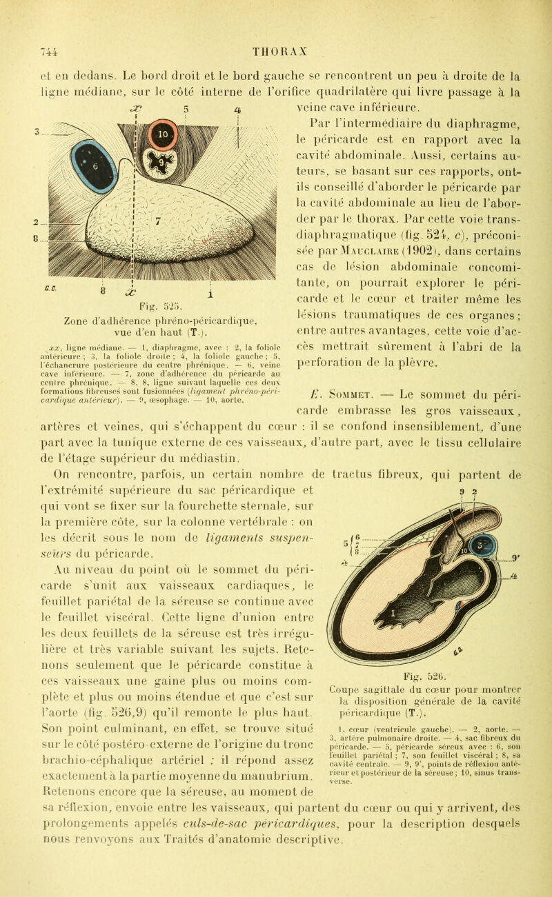 et en dedans. Le bord droit et le bord gauche se rencontrent un peu à droite de la ligne médiane, sur le côté interne de l’orifice quadrilatère qui livre passage à la veine cave inférieure. Par l’intermédiaire du diaphragme, le péricarde est en rapport avec la cavité abdominale. Aussi, certains au- teurs, se basant sur ces rapports, ont- ils conseillé d’aborder le péricarde par la cavité abdominale au lieu de l’abor- der par le thorax. Par cette voie trans- diaphragmatique (fig. 524, c), préconi- sée parMAucLAiRE (1902), dans certains cas de lésion abdominale concomi- tante, on pourrait explorer le péri- carde et le cœur et traiter même les lésions traumatiques de ces organes; entre autres avantages, cette voie d’ac- cès mettrait sûrement à l’abri de la perforation de la plèvre. E. Sommet. — Le sommet du péri- carde embrasse les gros vaisseaux, artères et veines, qui s’échappent du cœur : il se confond insensiblement, d’une part avec la tunique externe de ces vaisseaux, d’autre part, avec le tissu cellulaire de l’étage supérieur du médiastin. On rencontre, parfois, un certain nombre de tractus fibreux, qui partent de l’extrémité supérieure du sac péricardique et qui vont se fixer sur la fourchette sternale, sur la première côte, sur la colonne vertébrale : on les décrit sous le nom de ligaments suspen- seürs du péricarde. Au niveau du point où le sommet du péri- carde s’unit aux vaisseaux cardiaques, le feuillet pariétal de la séreuse se continue avec le feuillet viscéral. Cette ligne d’union entre les deux feuillets de la séreuse est très irrégu- lière et très variable suivant les sujets. Rete- nons seulement que le péricarde constitue à ces vaisseaux une gaine plus ou moins com- plète et plus ou moins étendue et que c’est sur l’aorte (fig. 52(5,9) qu’il remonte le plus haut. Son point culminant, en effet, se trouve situé sur le côté postéro-externe de l’origine du tronc brachio-céphalique artériel : il répond assez exactement a la partie moyenne du manubrium. Retenons encore que la séreuse, au moment de sa réflexion, envoie entre les vaisseaux, qui partent du cœur ou qui y arrivent, des prolongements appelés culs-de-sac péricardiques, pour la description desquels nous renvoyons aux Traités d’anatomie descriptive. ? 2 Fig. 526. Coupe sagittale du cœur pour montrer la disposition générale de la cavité péricardique (T.). 1, cœur (ventricule gauche). — 2, aorte. — 3, artcre pulmonaire droite. — 4, sac fibreux du péricarde. — 5, péricarde séreux avec : C, son feuillet pariétal ; 7, son feuillet viscéral ; 8, sa cavité centrale. — 9, 9’, points de réflexion anté- rieur et postérieur de la séreuse ; 10, sinus trans- verse. Fig. 525. Zone d’adhérence phréno-péricardique, vue d’en haut (T.). xx, ligne médiane. — 1, diaphragme, avec : 2, la foliole antérieure ; 3, la foliole droite ; 4, la foliole gauche ; 5, l’échancrure postérieure du centre phrénique. — 6, veine cave inférieure. — 7, zone d’adhérence du péricarde au centre phrénique. — 8, 8, ligne suivant laquelle ces deux formations fibreuses sont fusionnées (ligament phréno-péri- cardique antérieur). — 9, œsophage. — 10, aorte.