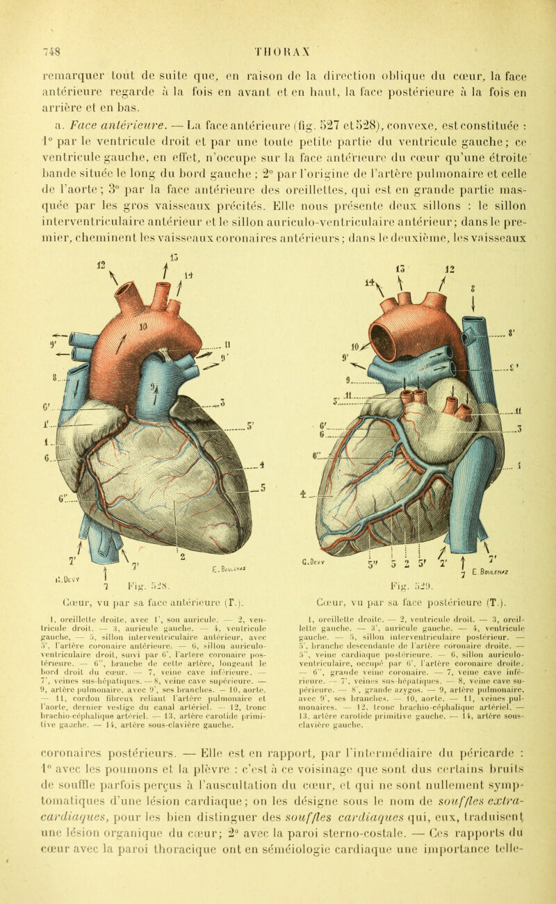remarquer tout de suite que, en raison de la direction oblique du cœur, la face antérieure regarde à la fois en avant et en haut, la face postérieure à la fois en arrière et en bas. a. Face antérieure. — La face antérieure (fig. 527 et 528), convexe, est constituée : 1° par le ventricule droit et par une toute petite partie du ventricule gauche; ce ventricule gauche, en effet, n’occupe sur la face antérieure du cœur qu’une étroite bande située le long du bord gauche ; 2° par l’origine de l’artère pulmonaire et celle de l’aorte; 3° par la face antérieure des oreillettes, qui est en grande partie mas- quée par les gros vaisseaux précités. Elle nous présente deux sillons : le sillon interventriculaire antérieur et le sillon auriculo-ventriculaire antérieur; dans le pre- mier, cheminent les vaisseaux coronaires antérieurs; dans le deuxième, les vaisseaux Cœur, vu par sa face antérieure (I\). 1. oreillelle droile, avec 1’, son auricule. — 2, ven- tricule droit. — H, auricule gauche. — 4, ventricule gauche, — o, sillon interventriculaire antérieur, avec a’, l’artère coronaire antérieure. — G, sillon auriculo- ventriculaire droit, suivi jiar 6’, l’artère coronaire pos- térieure. — G”, branche de cette artère, longeant le bord droit du cœur. — 7, veine cave inférieure. — 7’, veines sus-hépatiques. — 8, veine cave supérieure. — 9, artère pulmonaire, avec 9’, ses branches. — 10, aorte. — 11, cordon fibreux reliant l'artère pulmonaire et l’aorte, dernier vestige du canal artériel. — 12, tronc brachio-céphalique artériel. — 13, artère carotide primi- tive gauche. — 14, artère sous-clavière gauche. 13 12 Fig. o29. Cœur, vu par sa face postérieure (T.). 1, oreillette droite. — 2, ventricule droit. — 3, oreil- lette gauche. — 3’, auricule gauche. — 4, ventricule gauche. — 5, sillon interventriculaire postérieur. — 5’, branche descendante de l’artère coronaire droite. — 5”, veine cardiaque postérieure. — 6, sillon auriculo- ventriculaire, occupé par 6’, l’artère coronaire droite. — 6”, grande veine coronaire. — 7, veine cave infé- rieure. — 7’, veines sus-hépatiques. — 8, veine cave su- périeure. — 8’, grande azygos. — 9, artère pulmonaire, avec 9’, ses branches. — 10, aorte. — 11, veines pul- monaires. — 12, tronc brachio-céphalique artériel. — 13, artère carotide primitive gauche. — 14, artère sous- clavière gauche. coronaires postérieurs. — Elle est en rapport, par l’intermédiaire du péricarde : 1° avec les poumons et la plèvre : c’est h ce voisinage que sont dus certains hruits de souffle parfois perçus à l’auscultation du cœur, et qui ne sont nullement symp- tomatiques d’une lésion cardiaque; on les désigne sous le nom de souffles extra- cardiaques, pour les bien distinguer des souffles cardiaques qui, eux, traduisent une lésion organique du cœur; 2° avec la paroi sterno-costale. — Ces rapports du cœur avec la paroi thoracique ont en séméiologie cardiaque une importance telle-