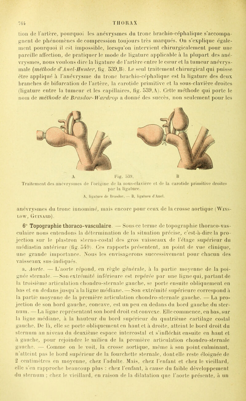 tion de l’artère, pourquoi les anévrysmes du tronc brachio-céphalique s’accompa- gnent de phénomènes de compression toujours très marqués. On s’explique égale- ment pourquoi il est impossible, lorsqu’on intervient chirurgicalement pour une pareille affection, de pratiquer le mode de ligature applicable à la plupart des ané- vrysmes, nous voulons dire la ligature de l’artère entre le cœur et la tumeur anévrys- male (méthode d'Anel-Hunter, fig. 539,B). Le seul traitement chirurgical qui puisse être appliqué à l’anévrysme du tronc brachio-céphalique est la ligature des deux branches de bifurcation de l’artère, la carotide primitive et la sous-clavière droites (ligature entre la tumeur et les capillaires, fig. 539,A). Cette méthode qui porte le nom de méthode de Brasdor-Wcirdrop a donné des succès, non seulement pour les A Fig. 539. B Traitement des anévrysmes de l'origine de la sous-clavière et de la carotide primitive droites par la ligature. A, ligature de Brasdor. — B, ligature d’Anel. anévrysmes du tronc innominé, mais encore pour ceux de la crosse aortique (Wins- low, Güinard). 6° Topographie thoraco-vasculaire. — Sous ce terme de topographie thoraco-vas- culaire nous entendons la détermination de la situation précise, c’est-à-dire la pro- jection sur le plastron sterno-costal des gros vaisseaux de l’étage supérieur du médiastin antérieur (fig. 540). Ces rapports présentent, au point de vue clinique, une grande importance. Nous les envisagerons successivement pour chacun des vaisseaux sus-indiqués. a. Aorte. — L’aorte répond, en règle générale, à la partie moyenne de la poi- gnée sternale.— Son extrémité inférieure est repérée par une ligne qui, partant de la troisième articulation chondro-sternale gauche, se porte ensuite obliquement en bas et en dedans jusqu’à la ligne médiane. — Son extrémité supérieure correspond à la partie moyenne de la première articulation chondro-sternale gauche. — La pro- jection de son bord gauche, concave, est un peu en dedans du bord gauche du ster- num. — La ligne représentant son bord droit est convexe. Elle commence, en bas, sur la ligne médiane, à la hauteur du bord supérieur du quatrième cartilage costal gauche. De là, elle se porte obliquement en haut et à droite, atteint le bord droit du sternum au niveau du deuxième espace intercostal et s’infléchit ensuite en haut et à gauche, pour rejoindre le milieu de la première articulation chondro-sternale gauche. — Gomme on le voit, la crosse aortique, même à son point culminant, n’atteint pas le bord supérieur de la fourchette sternale, dont elle reste éloignée de 2 centimètres en moyenne, chez l’adulte. Mais, chez l’enfant et chez le vieillard, elle s’en rapproche beaucoup plus : chez l’enfant, à cause du faible développement du sternum ; chez le vieillard, en raison de la dilatation que l’aorte présente, à un