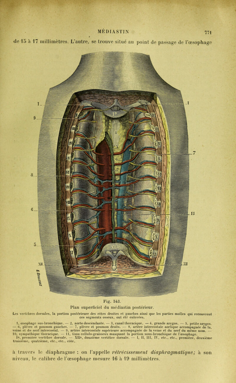 de 15 à J 7 millimètres. L’autre, se trouve situé au point de passage de l’œsophage Fig. 543. Plan superficiel du médiastin postérieur. Les vertèbres dorsales, la portion postérieure des côtes droites et gauches ainsi que les parties molles qui recouvrent ces segments osseux, ont été enlevées. 1, œsophage sus-bronchique. — 2, aorte descendante. — 3, canal thoracique. —4, grande azygos. — 5, petite azygos. -— 6, plèvre et poumon gauches. — 7, plèvre et poumon droits. — 8, artère intercostale aortique accompagnée de la, veine et du nerf intercostal. — 9, artère intercostale supérieure accompagnée de la veine et du nerf du même nom. — 10, sympathique thoracique. — 11, tissu cellulo-graisseux masquant la portion sous-bronchique de l'œsophage. Id, première vertèbre dorsale. — XUd, douzième vertèbre dorsale. — I, II, 111, 1Y, etc., etc., première, deuxième troisième, quatrième, etc., etc., côte. à travers le diaphragme : on l’appelle rétrécissement diaphragmatique ; à son niveau, le calibre de l’œsophage mesure 16 à 19 millimètres.