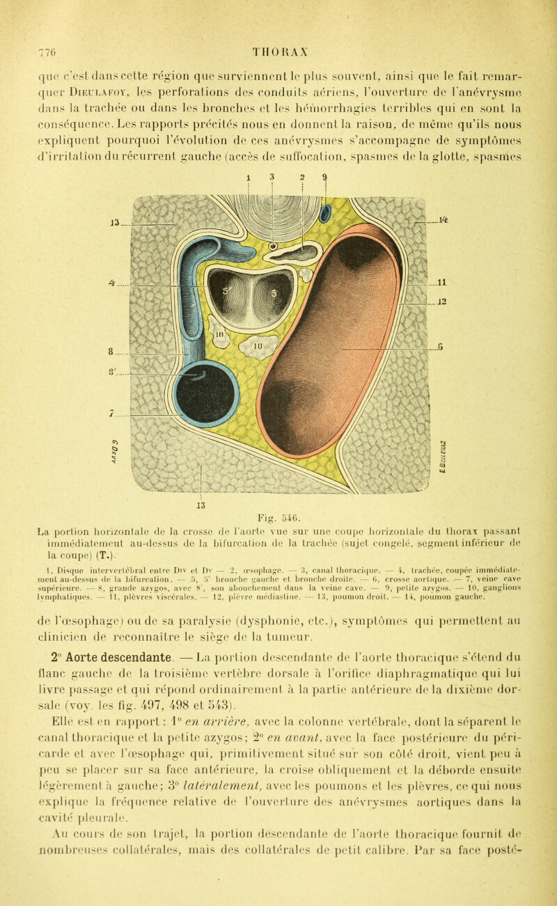 que c’est dans cette région que surviennent le plus souvent, ainsi que le fait remar- quer Dieulafoy, les perforations des conduits aériens, l’ouverture de l'anévrysme dans la trachée ou dans les bronches et les hémorrhagies terribles qui en sont la conséquence. Les rapports précités nous en donnent la raison, de même qu’ils nous expliquent pourquoi l’évolution de ces anévrysmes s’accompagne de symptômes d’irritation du récurrent gauche (accès de suffocation, spasmes delà glotte, spasmes 1 3 2 9 13 Fig. 546. La portion horizontale de la crosse de l’aorte vue sur une coupe horizontale du thorax passant immédiatemeut au-dessus de la bifurcation de la trachée (sujet congelé, segment inférieur de la coupe) (T.)- 1, Disque intervertébral entre Div et Dv — 2, œsophage. — 3, canal thoracique. — 4, trachée, coupée immédiate- ment au-dessus de la bifurcation. — 5, 5’ bronche gauche et bronche droite. — G, crosse aortique. — 7, veine cave supérieure. — 8, grande azygos, avec 8’, son abouchement dans la veine cave. — 9, petite azygos. — 10, ganglions lymphatiques. — 11, plèvres viscérales. — 12, plèvre médiastine. — 13, poumon droit. — 14, poumon gauche. de l’œsophage) ou de sa paralysie (dysphonie, etc.), symptômes qui permettent au clinicien de reconnaître le siège de la tumeur. 2° Aorte descendante. —La portion descendante de l’aorte thoracique s’étend du flanc gauche de la troisième vertèbre dorsale à l’orifice diaphragmatique qui lui livre passage et qui répond ordinairement à la partie antérieure de la dixième dor- sale (voy. les fig. 497, 498 et 543). Elle est en rapport : 10 en arrière, avec la colonne vertébrale, dont la séparent le canal thoracique et la petite azygos; 2° en avant, avec la face postérieure du péri- carde et avec l’œsophage qui, primitivement situé sur son côté droit, vient peu à peu se placer sur sa face antérieure, la croise obliquement et la déborde ensuite légèrement à gauche; 3° latéralement, avec les poumons et les plèvres, ce qui nous explique la fréquence relative de l’ouverture des anévrysmes aortiques dans la cavité pleurale. Au cours de son trajet, la portion descendante de l’aorte thoracique fournit de nombreuses collatérales, mais des collatérales de petit calibre. Par sa face posté-