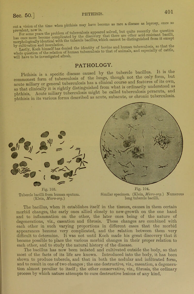 Sec. 50.] ruilll'Jlu' out a vision of the time when phthisis may have become as rare a disease as leprosy, once so bacillusjwlucli c.n.t be dUtinguiehed from it except by Ration “J^SSS'enied the identity of bovine and human tuberculosis, so that the whde question of the relation of human tuberculosis to that of animals, and especially of cattle, will have to be investigated afresh. PATHOLOGY. Phthisis is a specific disease caused by the tubercle bacillus. It is the commonest form of tuberculosis of the lungs, though not the only form but acute miliary or general tuberculosis has a clinical course and features of its own, so that clinically it is rightly distinguished from what is ordinarily understood as phthisis. Acute miliary tuberculosis might be called tuberculosis peracuta and phthisis in its various forms described as acute, subacute, or chronic tubeiculosis. Fig. 103. Tubercle bacilli from human sputum. (Klein, Micro-org.) Fig. 104. Similar specimen. (Klein, Micro-org.) Numerous long tubercle bacilli. The bacillus, when it establishes itself in the tissues, causes in them certain morbid changes, the early ones allied closely to new-growth on the one hand and to inflammation on the other, the later ones being of the nature of degenerations, viz., caseation and fibrosis. These changes are combined with each other in such varying proportions in different cases that the morbid appearances become very complicated, and the relation between them very difficult to determine. It was not until Koch made his great discovery that it became possible to place the various morbid changes in their proper relation to each other, and to study the natural history of the disease. The bacillus has now been isolated and cultivated outside the body, so that most of the facts of its life are known. Introduced into the body, it has been shown to produce tubercle, and that in both the nodular and infiltrated form, and to result in one of two changes ; the one destructive, viz., caseation, a degenera- tion almost peculiar to itself; the other conservative, viz., fibrosis, the ordinary process by which nature attempts to cure destructive lesions of any kind.