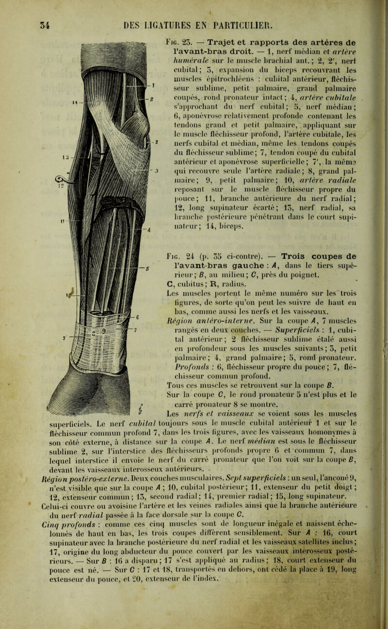 Fig. 23. — Trajet et rapports des artères de l’avant-bras droit. — 1, nerf médian et artère humérale sur le muscle brachial ant. ; 2, 2', nert cubital ; 3, expansion du biceps recouvrant les muscles épitrochléens : cubital antérieur, fléchis- seur sublime, petit palmaire, grand palmaire coupés, rond pronateur intact ; 4, artère cubitale s’approchant du nerf cubital; 5, nerf médian; 6, «aponévrose relativement profonde contenant les tendons grand et petit palmaire, appliquant sur le muscle fléchisseur profond, l’artère cubitale, les nerfs cubital et médian, même les tendons coupés du fléchisseur sublime; 7, tendon coupé du cubital antérieur et aponévrose superficielle; 7', la même qui recouvre seule l’artère radiale ; 8, grand pal- maire; 9, petit palmaire; 10, artère radiale reposant sur le muscle fléchisseur propre du pouce; 11, branche antérieure du nerf radial; 12, long supinateur écarté; 13, nerf radial, sa branche postérieure pénétrant dans le court supi- nateur; 14, biceps. Fig. 24 (p. 55 ci-contre). — Trois coupes de l’avant-bras gauche : A, dans le tiers supé- rieur^ B, au milieu; C, près du poignet. C, cubitus; R, radius. Les muscles portent le même numéro sur les trois ligures, de sorte qu’on peut les suivre de haut en bas, comme aussi les nerfs et les vaisseaux. Région anléro-interne. Sur la coupe A, 7 muscles rangés en deux couches. — Superficiels : 1, cubi- tal antérieur ; 2 fléchisseur sublime étalé aussi en profondeur sous les muscles suivants; 5, petit palmaire ; 4, grand palmaire ; 5, rond pronateur. Profonds : 6, fléchisseur propre du pouce; 7, flé- chisseur commun profond. Tous ces muscles se retrouvent sur la coupe B. Sur la coupe C, le rond pronateur 5 n’est plus et le carré pronateur 8 se montre. Les nerfs et vaisseaux se voient sous les muscles superficiels. Le nerf cubital toujours sous le muscle cubital antérieur 1 et sur le fléchisseur commun profond 7, dans les trois ligures, avec les vaisseaux homonymes à son côté externe, «à distance sur la coupe A. Le nerf médian est sous le fléchisseur sublime 2, sur l’interstice des fléchisseurs profonds propre 6 et commun 7, dans lequel interstice il envoie le nerf du carré pronateur que l’on voit sur la coupe B, devant les vaisseaux interosseux antérieurs. Régio n postéro-exlerne. Deux couches musculaires. Sept superficiels : un seul, l’anconé 9, n’est visible que sur la coupe A ; 10, cubital postérieur; 11, extenseur du petit doigt ; 12, extenseur commun ; 13, second radial ; 14, premier radial ; 15, long supinateur. Celui-ci couvre ou avoisine l’artère et les veines radiales ainsi que la branche antérieure du nerf radial passée à la face dorsale sur la coupe C. Cinq profonds : comme ces cinq muscles sont de longueur inégale et naissent éche- lonnés de haut en bas, les trois coupes diffèrent sensiblement. Sur A : 16, court supinateur avec la branche postérieure du nerf radial et lés vaisseaux satellites inclus; 17, origine du long abducteur du pouce couvert par les vaisseaux interosseux posté- rieurs. — Sur B : 16 a disparu; 17 s’est appliqué au radius; 18, court extenseur du pouce est né. — Sur C : 17 et 18, transportés en dehors, ont cédé la place à 19, long extenseur du pouce, et 20, extenseur de l’index.