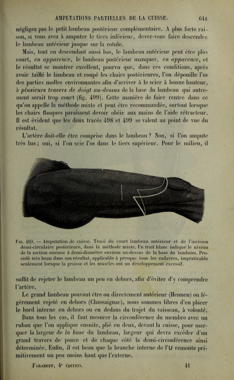 négligez pas le petit lambeau postérieur complémentaire. A plus forte rai- son, si vous avez à amputer le tiers inférieur, devez-vous faire descendre le lambeau antérieur jusque sur la rotule. Mais, tout en descendant aussi bas, le lambeau antérieur peut être plus court, en apparence, le lambeau postérieur manquer, en apparence, et le résultat se montrer excellent, pourvu que, dans ces conditions, après avoir taillé le lambeau et coupé les chairs postérieures, l’on dépouille l’os des parties molles environnantes afin d’arriver à le scier à bonne hauteur, à plusieurs travers de doigt au-dessus de la base du lambeau qui autre- ment serait trop court (fig. 499). Cette manière de faire rentre dans ce qu’on appelle la méthode mixte et peut être recommandée, surtout lorsque les chairs flasques paraissent devoir obéir aux mains de l’aide rétracteur. Il est évident que les deux tracés 498 et 499 se valent au point de vue du résultat. L’artère doit-elle être comprise dans le lambeau ? Non, si l’on ampute très bas; oui, si l’on scie l’os dans le tiers supérieur. Pour le milieu, il Fig. 499. — Amputation de cuisse. Tracé du court lambeau antérieur et de l’incision demi-circulaire postérieure, dans la méthode mixte. Un trait blanc indique le niveau de la section osseuse à demi-diamètre environ au-dessus de la base du lambeau. Pro- cédé très beau dans son résultat, applicable à presque tous les cadavres, impraticable seulement lorsque la graisse et les muscles ont un développement excessif. suffit de rejeter le lambeau un peu en dehors, afin d’éviter d’y comprendre l’artère. Le grand lambeau pouvant être ou directement antérieur (Hennen) ou lé- gèrement rejeté en dehors (Chassaignac), nous sommes libres d’en placer le bord interne en dehors ou en dedans du trajet du vaisseau, à volonté. Dans tous les cas, il faut mesurer la circonférence du membre avec un ruban que l’on applique ensuite, plié en deux, devant la cuisse, pour mar- quer la largeur de la base du lambeau, largeur qui devra excéder d'un grand travers de pouce et de chaque côté la demi-circonférence ainsi déterminée. Enfin, il est beau que la branche interne de l’U remonte pri- mitivement un peu moins haut que l’externe. FaIUBEIJF, 4e ÉDITJQX. 41