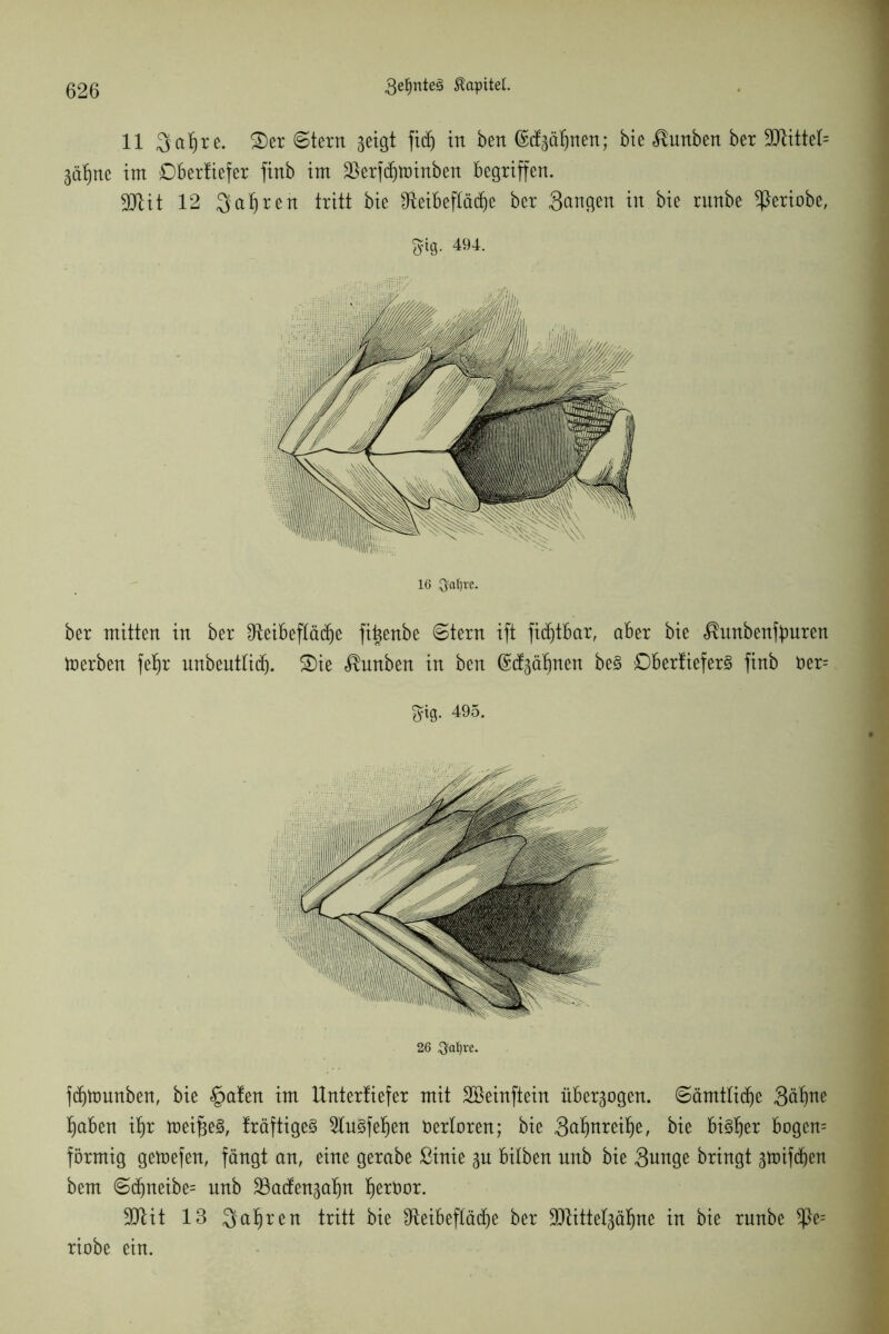 11 Satire. £>er ©lern geigt fidj in ben (Stf^nen; bie ^unben ber 9DUttet= im Obertiefer finb im äterfdjtoinben begriffen. 3Jlit 12 Sauren tritt bie Sieibefläc^e ber Sangen in bie rnnbe ^ßeriobe, m 494. 16 ^al)re. ber mitten in ber ^teibeftädje fi^enbe ©tern ift fidjtbar, aber bie «®unbenftmren foerben fet)r unbeuttid). S)ie Knaben in ben ©dgäfjnen be§ £)berfiefer§ finb üer= g=ig. 495. 26 $aljre. fdjtounben, bie §a!en im Untertiefer mit SBeinftein überzogen, ©amtliche Sätine f)aben it)r meines, fräftige§ 2lu§fet)en öerbren; bie Safynxäfy, bie bisher bogen= förmig gemefen, fängt an, eine gerabe Sinie gu bilben nnb bie Sange bringt gtrifc^en bem ©d)neibe= nnb SSadenga^n jfyertmr. 9ttit 13 Satjren tritt bie Dteibeftädje ber SDtittelgä^ne in bie rnnbe *Pe= riobe ein.