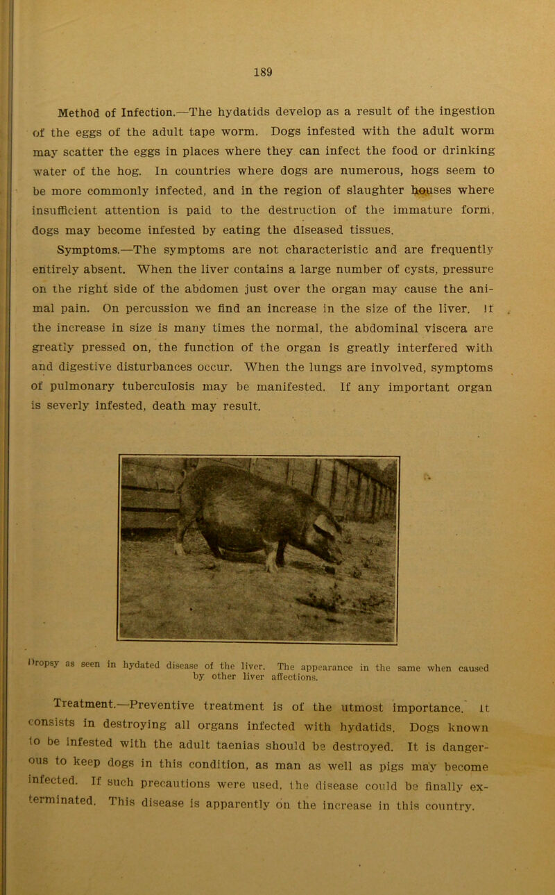 Method of Infection.—The hydatids develop as a result of the ingestion of the eggs of the adult tape worm. Dogs infested with the adult worm may scatter the eggs in places where they can infect the food or drinking water of the hog. In countries where dogs are numerous, hogs seem to be more commonly infected, and in the region of slaughter houses where insufficient attention is paid to the destruction of the immature forni. dogs may become infested by eating the diseased tissues. Symptoms.—The symptoms are not characteristic and are frequently entirely absent. When the liver contains a large number of cysts, pressure on the right side of the abdomen just over the organ may cause the ani- mal pain. On percussion we find an increase in the size of the liver. If the increase in size is many times the normal, the abdominal viscera are greatly pressed on, the function of the organ is greatly interfered with and digestive disturbances occur. When the lungs are involved, symptoms of pulmonary tuberculosis may be manifested. If any important organ is severly infested, death may result. Dropsy as seen in hydated disease of the liver. The appearance in the same when caused by other liver affections. Treatment. Preventive treatment is of the utmost importance, it consists in destroying all organs infected with hydatids. Dogs known to be infested with the adult taenias should be destroyed. It is danger- ous to keep dogs in this condition, as man as well as pigs may become infected. If such precautions were used, the disease could be finally ex- terminated. This disease is apparently on the increase in this country.