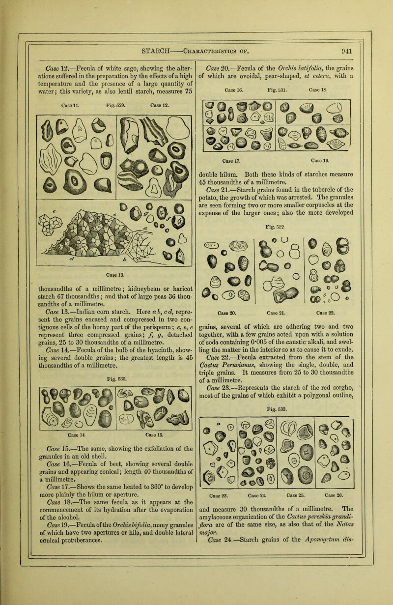 Case 12.—Fecula of white sago, showing the alter- ations suffered in the preparation by the effects of a high temperature and the presence of a large quantity of water; this variety, as also lentil starch, measures 75 Case 11. Fig. 629. Case 12. Case 13. thousandths of a millimetre; kidneybean or haricot starch 67 thousandths; and that of large peas 36 thou- sandths of a millimetre. Case 13.—Indian corn starch. Here at, cd, repre- sent the grains encased and compressed in two con- tiguous cells of the homy part of the perisperm; e, e, e represent three compressed grains; /, g, detached grains, 25 to 30 thousandths of a millimetre. Case 14.—Fecula of the bulb of the hyacinth, show- ing several double grains; the greatest length is 45 thousandths of a millimetre. Fig. 530. Case 15.—The same, showing the exfoliation of the granules in an old shell. Case 16.—Fecula of beet, showing several double grains and appearing conical; length 40 thousandths of a millimetre. Case 17.—Shows the same heated to 360° to develop more plainly the hilum or aperture. Case 18.—The same fecula as it appears at the commencement of its hydration after the evaporation of the alcohol. Case 19.—F ecula of the Orchis bifolia, many granules of which have two apertures or hila, and double lateral conical protuberances. Case 20.—Fecula of the Orchis latifolia, the grains of which are ovoidal, pear-shaped, et cetera, with a Case 16. Fig. 531. Case IS. ^0 ^ 0 IP” ^ <Sg| ©@ Case 17. Case 19. double hilum. Both these kinds of starches measure 45 thousandths of a millimetre. Case 21.—Starch grains found in the tubercle of the potato, the growth of which was arrested. The granules are seen forming two or more smaller corpuscles at the expense of the larger ones; also the more developed Fig. 532. Case 20. Case 21. Case 22. grains, several of which are adhering two and two together, with a few grains acted upon with a solution of soda containing 0'005 of the caustic alkali, and swel- ling the matter in the interior so as to cause it to exude. Case 22.—Fecula extracted from the stem of the Cactus Peruvianus, showing the single, double, and triple grains. It measures from 25 to 30 thousandths of a millimetre. Case 23.—Represents the starch of the red sorgho, most of the grains of which exhibit a polygonal outline, Fig. 533. Case 23. Case 24. Case 25. Case 26. and measure 30 thousandths of a millimetre. The amylaceous organization of the Cactus pereslcia grancli- flora are of the same size, as also that of the Naias major. Case 24.—Starch grains of the Aponogrtum dis-