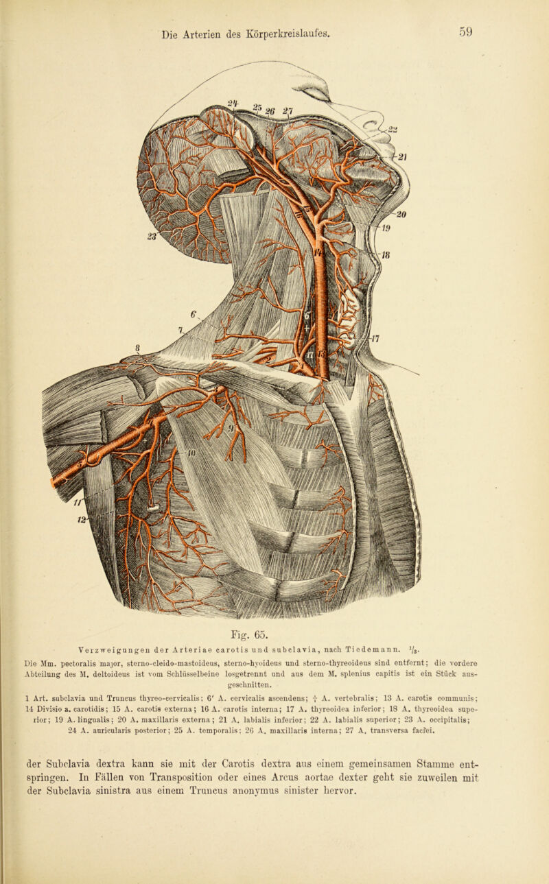 Fig. 65. Verzweigungen der Arteriae carotis und subclavia, nach Tiedemann. Vs- Die Mm. pectoralis major, sterno-cleido-mastoideus, sterno-hyoideus und sterno-thyreoideus sind entfernt; die vordere Abteilung des M. deltoideus ist vom Schlüsselbeine losgetrennt und aus dem M. splenius capitis ist ein Stück aus- geschnitten. 1 Art. subclavia und Truncus tbyreo-cervicalis; 6' A. cervicalis ascendens; f A. vertebralis; 13 A. carotis communis; 14 Divisio a. carotidis; 15 A. carotis externa; 16 A. carotis interna; 17 A. thyreoidea inferior; 18 A. thyreoidea supo- rior; 19 A. lingualis; 20 A. maxillaris externa; 21 A. labialis inferior; 22 A. labialis superior; 23 A. occipitalis; 24 A. auricularis posterior; 25 A. temporalis; 26 A, maxillaris interna; 27 A. transversa facfei. der Subclavia dextra kann sie mit der Carotis dextra aus einem gemeinsamen Stamme ent- springen. In Fällen von Transposition oder eines Arcus aortae dexter gebt sie zuweilen mit der Subclavia sinistra aus einem Truncus anonjunus sinister hervor.