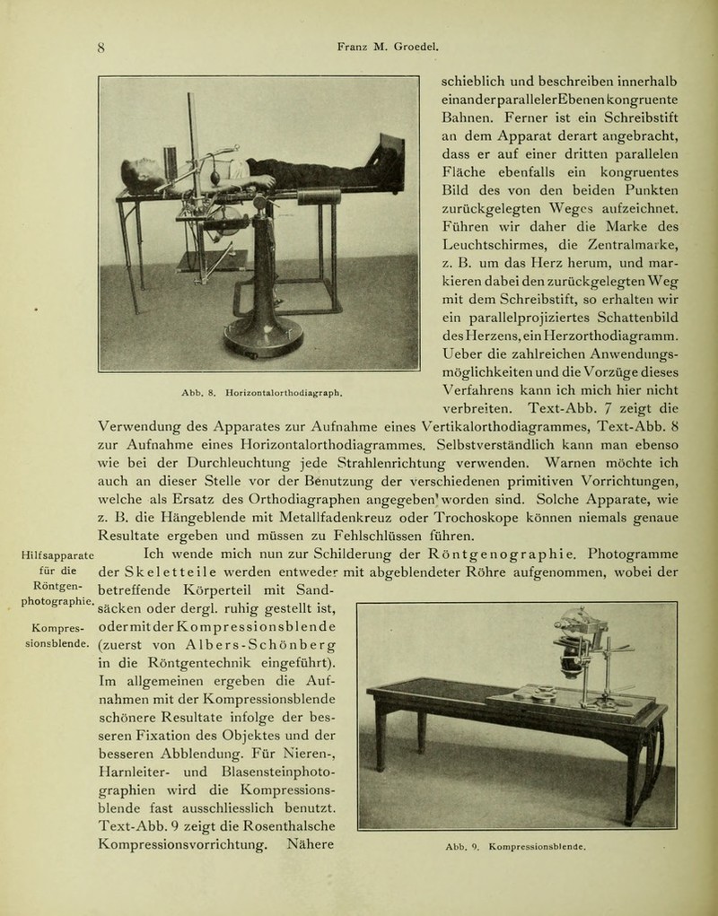 Hilfsapparate für die Röntgen- photographie. Kompres- sionsblende. Abb. 8. Horizontalorthodiagraph. schieblich und beschreiben innerhalb einander parallelerEbenen kongruente Bahnen. Ferner ist ein Schreibstift an dem Apparat derart angebracht, dass er auf einer dritten parallelen Fläche ebenfalls ein kongruentes Bild des von den beiden Punkten zurückgelegten Weges aufzeichnet. Führen wir daher die Marke des Leuchtschirmes, die Zentralmarke, z. B. um das Herz herum, und mar- kieren dabei den zurückgelegten Weg mit dem Schreibstift, so erhalten wir ein parallelprojiziertes Schattenbild des Herzens, ein Herzorthodiagramm. Ueber die zahlreichen Anwendungs- möglichkeiten und die Vorzüge dieses Verfahrens kann ich mich hier nicht verbreiten. Text-Abb. 7 z;eigt die Verwendung des Apparates zur Aufnahme eines Vertikalorthodiagrammes, Text-Abb. 8 zur Aufnahme eines Horizontalorthodiagrammes. Selbstverständlich kann man ebenso wie bei der Durchleuchtung jede Strahlenrichtung verwenden. Warnen möchte ich auch an dieser Stelle vor der Benutzung der verschiedenen primitiven Vorrichtungen, welche als Ersatz des Orthodiagraphen angegeben1 worden sind. Solche Apparate, wie z. B. die Hängeblende mit Metallfadenkreuz oder Trochoskope können niemals genaue Resultate ergeben und müssen zu Fehlschlüssen führen. Ich wende mich nun zur Schilderung der Röntgenographie. Photogramme der S kel e11 e i 1 e werden entweder mit abgeblendeter Röhre aufgenommen, wobei der betreffende Körperteil mit Sand- säcken oder dergl. ruhig gestellt ist, oder mit der Kompressionsblende (zuerst von Albers-Schönberg in die Röntgentechnik eingeführt). Im allgemeinen ergeben die Auf- nahmen mit der Kompressionsblende schönere Resultate infolge der bes- seren Fixation des Objektes und der besseren Abblendung. Für Nieren-, Harnleiter- und Blasensteinphoto- graphien wird die Kompressions- blende fast ausschliesslich benutzt. Text-Abb. 9 zeigt die Rosenthalsche Kompressionsvorrichtung. Nähere Abb. 9. Kompressionsblende.