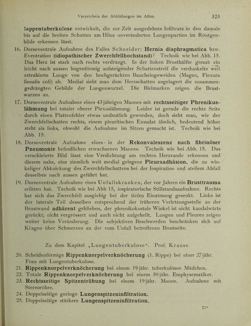 lappentuberkulose entwickelt, die zur Zeit ausgedehnte Infiltrate in den damals bis auf die breiten Schatten am Hilus unveränderten Lungenpartien im Röntgen- bilde erkennen lässt. 16. Dorsoventrale Aufnahme des Falles Schneider: Hernia diaphragmatica bzw. Eventration (idiopathischer Zwerchfellhochstand)? Technik wie bei Abb. 15. Das Herz ist stark nach rechts verdrängt. In der linken Brusthälfte grenzt ein leicht nach aussen bogenförmig aufsteigender Schattenstreif die verdunkelte weil retrahierte Lunge von den hochgerückten Baucheingeweiden (Magen, Flexura lienalis coli) ab. Medial sieht man dem Herzschatten angelagert die zusammen- gedrängten Gebilde der Lungenwurzel. Die Bleimarken zeigen die Brust- warzen an. 17- Dorsoventrale Aufnahme eines 43 jährigen Mannes mit rechtsseitiger Phrenikus- lähmung bei totaler oberer Plexuslähmung. Leider ist gerade die rechte Seite durch einen Plattenfehler etwas undeutlich geworden, doch sieht man, wie der Zwerchfellschatten rechts, einem pleuritischen Exsudat ähnlich, bedeutend höher steht als links, obwohl die Aufnahme im Sitzen gemacht ist. Technik wie bei Abb. 15. 18. Dorsoventrale Aufnahme eines - in der Rekonvaleszenz nach fibrinöser Pneumonie befindlichen erwachsenen Mannes. Technik wie bei Abb. 15. Das verschleierte Bild lässt eine Verdichtung am rechten Herzrande erkennen und diesem nahe, eine ziemlich weit medial gelegene Pleuraadhäsion, die zu win- keliger Abknickung des Zwerchfellschattens bei der Inspiration und steilem Abfall desselben nach aussen geführt hat. 19. Dorsoventrale Aufnahme eines Unfallskranken, der Vorjahren ein Brusttrauma erlitten hat. Technik wie bei Abb 15, inspiratorische Stillstandsaufnahme. Rechts hat sich das Zwerchfell ausgiebig bei der tiefeo Einatmung gesenkt. Links ist der laterale Teil desselben entsprechend der früheren Yerletzungsstelle an der Brustwand adhärent geblieben, der phrenikokostale Winkel ist nicht kaudalwärts gerückt, nicht vergrössert und auch nicht aufgehellt. Lungen und Pleuren zeigen weiter keine Veränderung. Die subjektiven Beschwerden beschränken sich auf Klagen über Schmerzen an der vom Unfall betroffenen Brustseite. Zu dem Kapitel „Lungentuberkulose“. Prof. Krause. 20. Scheidenförmige Rippenknorpelverknöcherung (1. Rippe) bei einer 27jähr. Frau mit Lungentuberkulose. 21. Rippenknorpelverknöcherung bei einem 19 jähr. tuberkulösen Mädchen. 22. Totale Rippenknorpelverknöcherung bei einem 50jähr. Emphysematiker. 23. Rechtsseitige Spitzentrübung bei einem 19jähr. Manne. Aufnahme mit Stereoröhre. 24. Doppelseitige geringe Lungenspitzeninfiltration. 25. Doppelseitige stärkere Lungenspitzeninfiltration. 21*