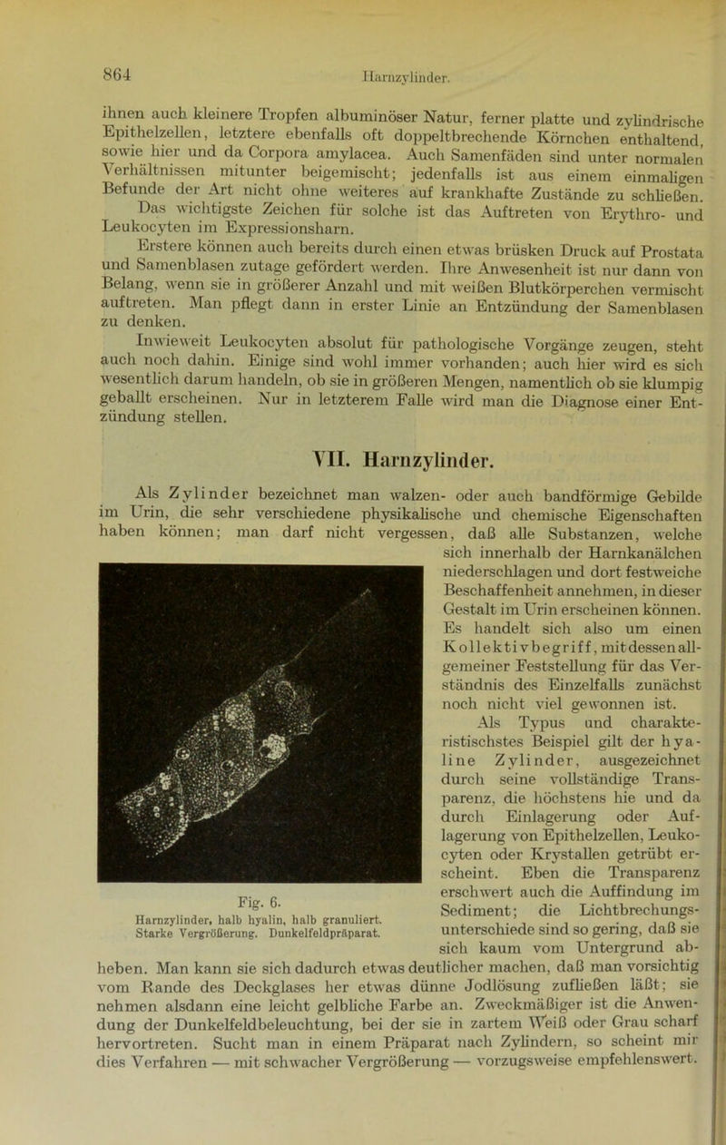 ihnen auch kleinere Tropfen albuminöser Natur, ferner platte und zylindrische Epithelzellen, letztere ebenfalls oft doppeltbrechende Körnchen enthaltend, sowie hier und da Corpora amylacea. Auch Samenfäden sind unter normalen Verhältnissen mitunter beigemischt; jedenfalls ist aus einem einmaligen Befunde der Art nicht ohne weiteres auf krankhafte Zustände zu schließen. Das wichtigste Zeichen für solche ist das Auftreten von Erythro- und Leukocyten im Expressionsharn. Erstere können auch bereits durch einen etwas brüsken Druck auf Prostata und Samenblasen zutage gefördert werden. Ihre Anwesenheit ist nur dann von Belang, wenn sie in größerer Anzahl und mit weißen Blutkörperchen vermischt auftreten. Man pflegt dann in erster Linie an Entzündung der Samenblasen zu denken. Inwieweit Leukocyten absolut für pathologische Vorgänge zeugen, steht auch noch dahin. Einige sind wohl immer vorhanden; auch liier wird es sich wesentlich darum handeln, ob sie in größeren Mengen, namentlich ob sie klumpig geballt erscheinen. Nur in letzterem Falle wird man die Diagnose einer Ent- zündung stellen. VII. Harnzylinder. Als Zylinder bezeichnet man walzen- oder auch bandförmige Gebilde im Urin, die sehr verschiedene physikalische und chemische Eigenschaften haben können; man darf nicht vergessen, daß alle Substanzen, welche sich innerhalb der Harnkanälchen niederschlagen und dort festweiche Beschaffenheit annehmen, in dieser Gestalt im Urin erscheinen können. Es handelt sich also um einen Kollektivbegriff, mitdessenall- gemeiner Feststellung für das Ver- ständnis des Einzelfalls zunächst noch nicht viel gewonnen ist. Als Typus und charakte- ristischstes Beispiel gilt der hya- line Zylinder, ausgezei chnet durch seine vollständige Trans- parenz, die höchstens hie und da durch Einlagerung oder Auf- lagerung von Epithelzellen, Leuko- cyten oder Krystallen getrübt er- scheint. Eben die Transparenz erschwert auch die Auffindung im Sediment; die Lichtbrechungs- Unterschiede sind so gering, daß sie sich kaum vom Untergrund ab- heben. Man kann sie sich dadurch etwas deutlicher machen, daß man vorsichtig vom Rande des Deckglases her etwas dünne Jodlösung zufließen läßt; sie nehmen alsdann eine leicht gelbliche Farbe an. Zweckmäßiger ist die Anwen- dung der Dunkelfeldbeleuchtung, bei der sie in zartem Weiß oder Grau scharf hervortreten. Sucht man in einem Präparat nach Zylindern, so scheint mir dies Verfahren — mit schwacher Vergrößerung — vorzugsweise empfehlenswert. Fig. 6. Harnzylinder, halb hyalin, halb granuliert. Starke Vergrößerung. Dunkelfeldprilparat.