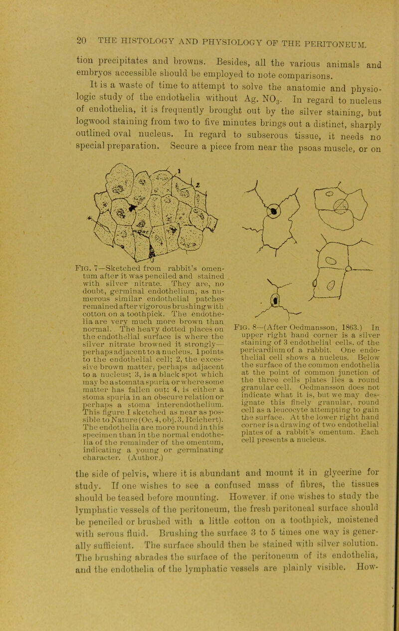 tion precipitates and browns. Besides, all the various animals and embryos accessible should be employed to note comparisons. It is a waste of time to attempt to solve the anatomic and physio- logic study of the endothelia without Ag. NO3. In regard to nucleus of endothelia, it is frequently brought out by the silver staining, but logwood staining from two to five minutes brings out a distinct, sharply outlined oval nucleus. In regard to subserous tissue, it needs no special preparation. Secure a piece from near the psoas muscle, or on Fig. 7—Sketched from rabbit’s omen- tum after it was penciled and stained with silver nitrate. They are, no douljt, g-erminal endothelium, as nu- merous similar endothelial patches remained after vigorous brushing w itb cotton on a toothpick. The endothe- lia are very much more brown than normal. The heavy dotted places on the endothelial surface is where the silver nitrate browned it strongly— perhaps adjacent to a nucleus. 1 points to the endothelial cell; 2, the exces- sive brown matter, perhaps adjacent to a nucleus; 3, is a black spot which may be astomata spuria or where some matter has fallen out: 4, is either a stoma spuria in an obscure relation or perhaps a stoma interendothelium. This figure I sketched as near as pos- sible to Nature (Oc. 4, obj. 3, Reichert). The endothelia are more round in this specimen than in the normal endothe- lia of the remainder of the omentum, indicating a young or germinating character. (Author.) Fig. 8—(After Oedraansson, 1863.) In upper right hand corner is a silver staining of 3 endothelial cells, of the pericardium of a rabbit. One endo- thelial cell shows a nucleus. Below the surface of the common endothelia at the point of common junction of the three cells plates lies a round granular cell. Oedraansson does not indicate what it is, but we may des- ignate this finely granular, round cell as a leucocyte attempting to gain tlie surface. At the lower right hand corner is a drawing of two endothelial plates of a rabbit's omentum. Each cell presents a nucleus. tlie side of pelvis, where it is abundant and mount it in glycerine for study. If one wishes to see a confused mass of fibres, the tissues should be teased l)efore mounting. However, if one wishes to study the lymphatic vessels of the peritoneum, the fresh peritoneal surface should be penciled or brushed with a little cotton on a toothpick, moistened with serous fluid. Brushing the surface 3 to 5 times one way is gener- ally sufficient. The surface should then lie stained with silver solution. The brushing abrades the surface of the peritoneum of its endothelia, and the endothelia of the lymphatic vessels are plainly visible. How-