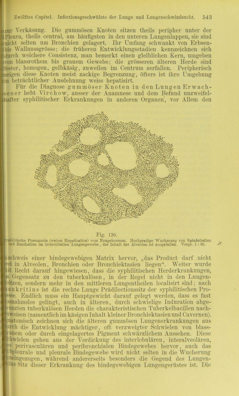 zur Verkäsung. Die gummösen Knoten sitzeu tlieils peripher unter der 1 Pleura, theils central, am häufigsten in den unteren Lungenlappen, sie sind nicht selten um Bronchien gelagert. Ihr Umfang schwankt von Erbsen- i bis Wallnussgrösse; die früheren Entwicklungsstadien kennzeichnen sich durch weichere Consistenz, man bemerkt einen glelbliclien Kern, umgeben .von blassrothem bis grauem Gewebe; die grösseren älteren Herde sind fester, homogen, gelbkäsig, zuweilen im Centrum zerfallen. Peripherisch zeigen diese Knoten meist zackige Begrenzung, öfters ist ihre Umgebung in beträchtlicher Ausdehnung weiss hepatisirt. Für die Diagnose gummöser Knoten in den Lungen Erwach- sener hebt Virchow, ausser der Anamnese und dem Befund unzweifel- hafter syphilitischer Erkrankungen in anderen Organen, vor Allem den Fig. 120. ■ philitische Pneumonie (weisse Hepatisation) vom Neugeborenen. Hochgradige Wucherung von Spindelzellen und Hundzellen im interstitiellen Lungengewebe, der Inhalt der Alveolen ist ausgefallen Vergr. 1 : 85. lachweis einer bindegewebigen Matrix hervor, „das Product darf nicht rei in Alveolen, Bronchien oder Bronchiektasien liegen“. Weiter wurde iit Recht darauf hingewiesen, dass die syphilitischen Herderkrankungen, »i Gegensatz zu den tuberkulösen, in der Regel nicht in den Lungen- ;ätzen, sondern mehr in den mittleren Lungentlieilen localisirt sind; nach sankritius ist die rechte Lunge Prädilectionssitz der syphilitischen Pro- esse. Endlich muss ein Hauptgewicht darauf gelegt werden, dass es fast ■isnahmslos gelingt, auch in älteren, durch schwielige Induration abge- renzten tuberkulösen Herden die charakteristischen Tuberkelbacillen nach- iweisen (namentlich im käsigen Inhalt kleiner Bronchiektasien und Cavernen). anatomisch zeichnen sich die älteren gummösen Lungenerkrankungen aus •ircli die Entwicklung mächtiger, oft verzweigter Schwielen vou blass- rauem oder durch eingelagertes Pigment schwärzlichem Aussehen. Diese Ihwielen gehen aus der Verdickung des interlobulären, interalveolären, p perivaseulären und peribronchialen Bindegewebes hervor, auch das Ibpleurale und pleurale Bindegewebe wird nicht selten in die Wucherung meingezogen, während andererseits besonders die Gegend des Lungen- äus Sitz dieser Erkrankung des bindegewebigen Lungengerüstes ist. Die