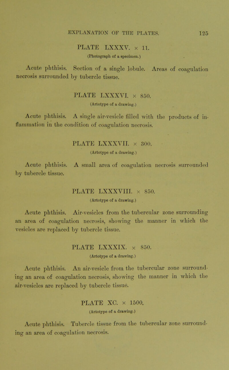 PLATE LXXXV. x 11. (Photograph of a specimen.) Acute phthisis. Section of a single lobule. Areas of coagulation necrosis surrounded by tubercle tissue. PLATE LXXXVI. x 850. (Artotype of a drawing.) Acute phthisis. A single air-vesicle tilled with the products of in- flammation in the condition of coagulation necrosis. PLATE LXXXVII. x 300. (Artotype of a drawing.) Acute phthisis. A small area of coagulation necrosis surrounded by tubercle tissue. PLATE LXXXVIII. x 850. (Artotype of a drawing.) Acute phthisis. Air-vesicles from the tubercular zone surrounding an area of coagulation necrosis, showing the manner in which the vesicles are replaced by tubercle tissue. PLATE LXXXIX. x 850. (Artotype of a drawing.) Acute phthisis. An air-vesicle from the tubercular zone surround- ing an area of coagulation necrosis, showing the manner in which the air-vesicles are replaced by tubercle tissue. PLATE XC. x 1500. (Artotype of a drawing.) Acute phthisis. Tubercle tissue from the tubercular zone surround- ing an area of coagulation necrosis.