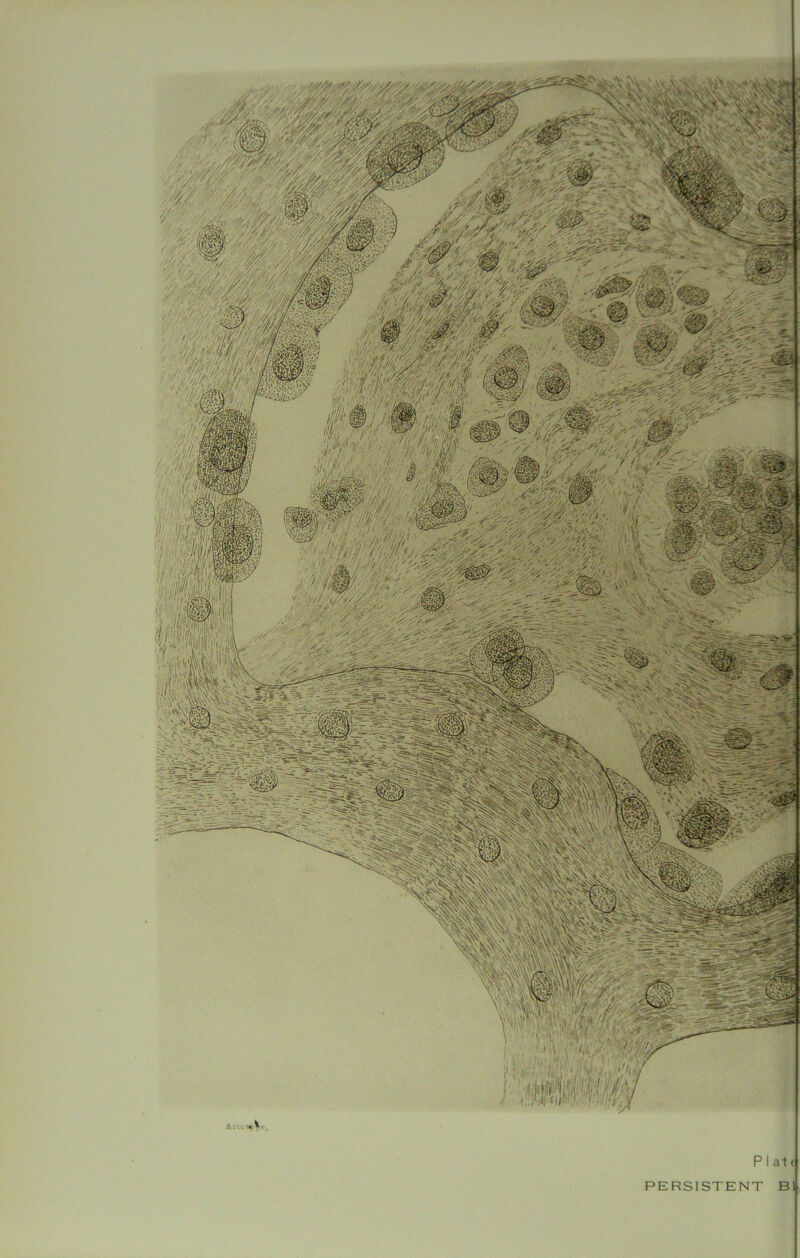 Plate PERSISTENT Bl