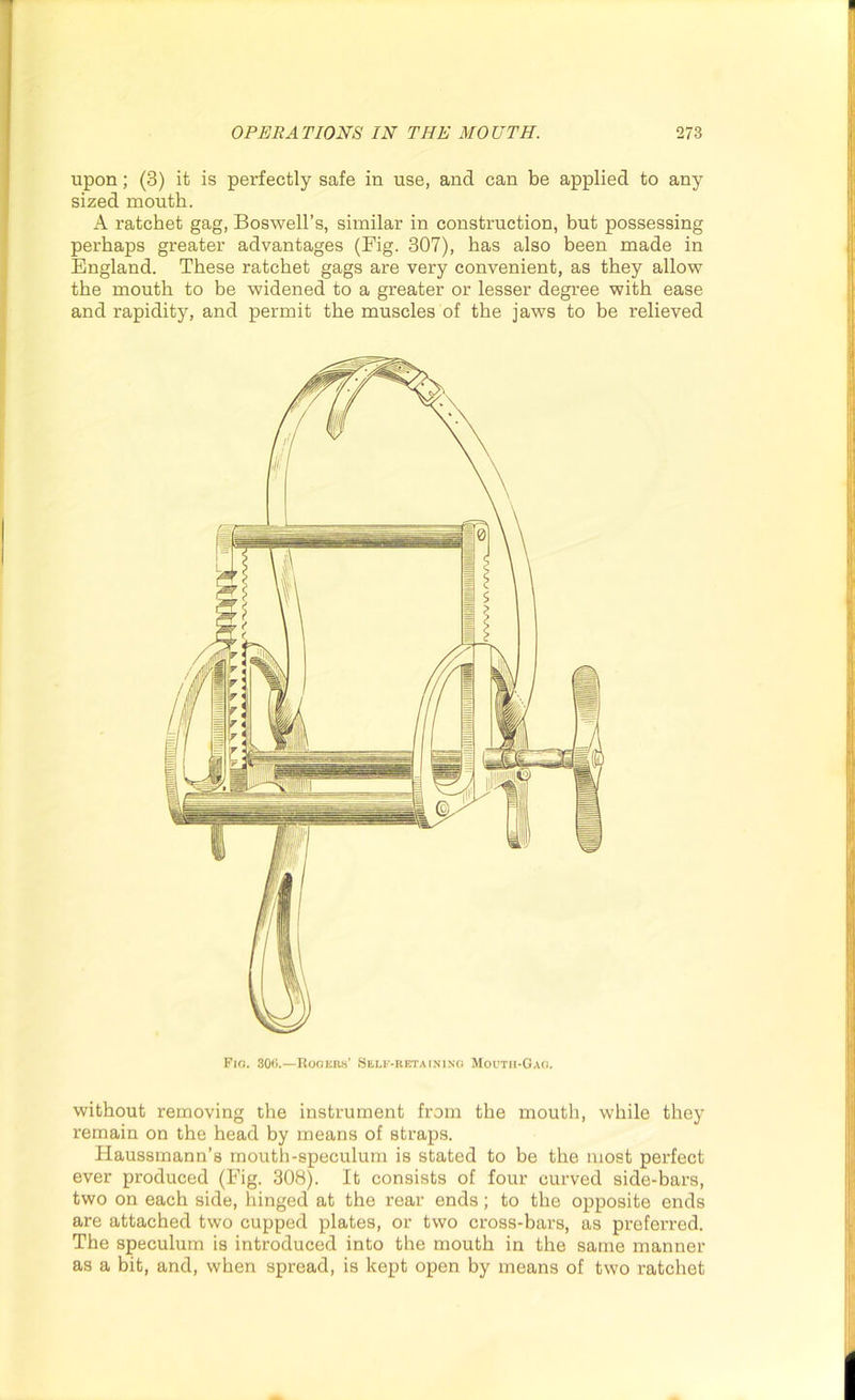 upon; (3) it is perfectly safe in use, and can be applied to any sized mouth. A ratchet gag, Boswell’s, similar in construction, but possessing perhaps greater advantages (Big. 307), has also been made in England. These ratchet gags are very convenient, as they allow the mouth to be widened to a greater or lesser degree with ease and rapidity, and permit the muscles of the jaws to be relieved Pig. 300.—Rogers' Self-retaining Mouth-Gag. without removing the instrument from the mouth, while they remain on the head by means of straps. Haussmann’s mouth-speculum is stated to be the most perfect ever produced (Fig. 308). It consists of four curved side-bars, two on each side, hinged at the rear ends; to the opposite ends are attached two cupped plates, or two cross-bars, as preferred. The speculum is introduced into the mouth in the same manner as a bit, and, when spread, is kept open by means of two ratchet