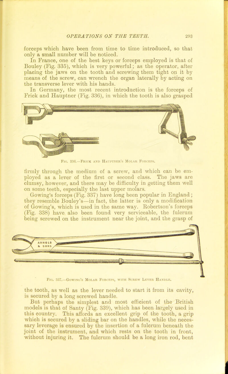 forceps which have been from time to time introduced, so that only a small number will be noticed. In France, one of the best keys or forceps employed is that of Bouley (Fig. 335), which is very powerful; as the operator, after placing the jaws on the tooth and screwing them tight on it by means of the screw, can wrench the organ laterally by acting on the transverse lever with his hands. In Germany, the most recent introduction is the forceps of Frick and Hauptner (Fig. 336), in which the tooth is also grasped Fio. 336.—Frick and Hauptner’.s Molar Forceps. firmly through the medium of a screw, and which can be em- ployed as a lever of the first or second class. The jaws are clumsy, however, and there may be difficulty in getting them well on some teeth, especially the last upper molars. Gowing’s forceps (Fig. 337) have long been popular in England; they resemble Bouley’s—in fact, the latter is only a modification of Gowing’s, which is used in the same way. Robertson’s forceps (Fig. 338) have also been found very serviceable, the fulcrum being screwed on the instrument near the joint, and the grasp of the tooth, as well as the lever needed to start it from its cavity, is secured by a long screwed handle. But perhaps the simplest and most efficient of the British models is that of Santy (Fig. 339), which has been largely used in this country. This affords an excellent grip of the tooth, a grip which is secured by a sliding bar on the handles, while the neces- sary leverage is ensured by the insertion of a fulcrum beneath the joint of the instrument, and which rests on the tooth in front, without injuring it. The fulcrum should be a long iron rod, bent