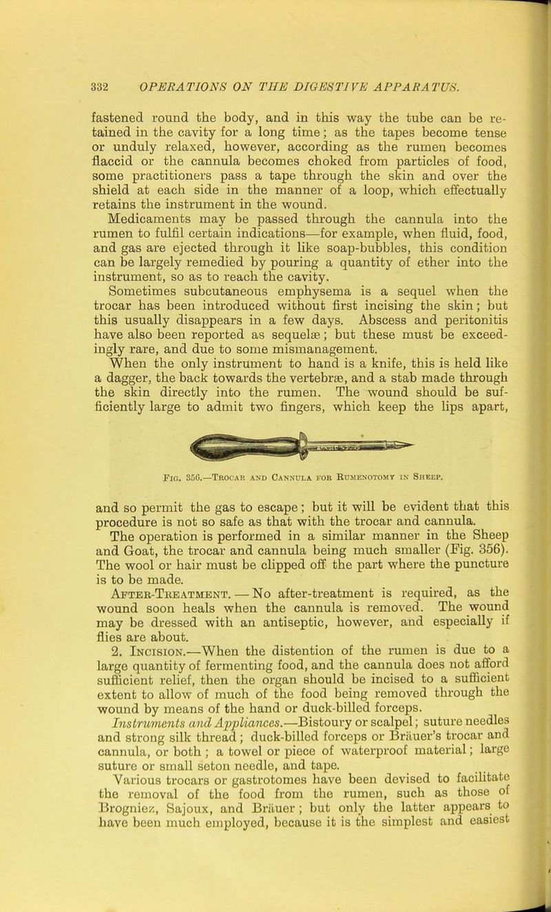 fastened round the body, and in this way the tube can be re- tained in the cavity for a long time; as the tapes become tense or unduly relaxed, however, according as the rumeu becomes flaccid or the cannula becomes choked from particles of food, some practitioners pass a tape through the skin and over the shield at each side in the manner of a loop, which effectually retains the instrument in the wound. Medicaments may be passed through the cannula into the rumen to fulfil certain indications—for example, when fluid, food, and gas are ejected through it like soap-bubbles, this condition can be largely remedied by pouring a quantity of ether into the instrument, so as to reach the cavity. Sometimes subcutaneous emphysema is a sequel when the trocar has been introduced without first incising the skin; but this usually disappears in a few days. Abscess and peritonitis have also been reported as sequelae; but these must be exceed- ingly rare, and due to some mismanagement. When the only instrument to hand is a knife, this is held like a dagger, the back towards the vertebrae, and a stab made through the skin directly into the rumen. The wound should be suf- ficiently large to admit two fingers, which keep the lips apart, Pig. 356.—Trocar and Cannula for Rumenotomy in Sheep. and so permit the gas to escape; but it will be evident that this procedure is not so safe as that with the trocar and cannula. The operation is performed in a similar manner in the Sheep and Goat, the trocar and cannula being much smaller (Fig. 356). The wool or hair must be clipped off the part where the puncture is to be made. After-Treatment. — No after-treatment is required, as the wound soon heals when the cannula is removed. The wound may be dressed with an antiseptic, however, and especially if flies are about. 2. Incision.—When the distention of the rumen is due to a large quantity of fermenting food, and the cannula does not afford sufficient relief, then the organ should be incised to a sufficient extent to allow of much of the food being removed through the wound by means of the hand or duck-billed forceps. Instruments and Appliances.—Bistoury or scalpel; suture needles and strong silk thread; duck-billed forceps or Brauer’s trocar and cannula, or both ; a towel or piece of waterproof material; large suture or small seton needle, and tape. Various trocars or gastrotomes have been devised to facilitate the removal of the food from the rumen, such as those of Brogniez, Sajoux, and Briiuer; but only the latter appears to have been much employed, because it is the simplest and easiest