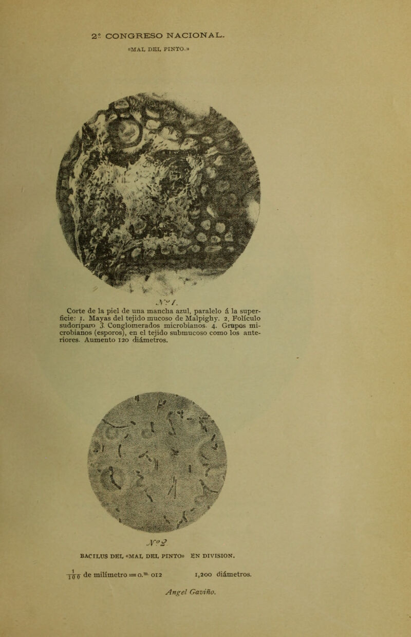 «MAL DEL PINTO.» ...v * JT?f. Corte de la piel de una mancha azul, paralelo á la super- ficie: i. Mayas del tejido mucoso de Malpighy. 2. Folículo sudoríparo 3 Conglomerados microbianos. 4. Grupos mi- crobianos (esporos), en el tejido submucoso como los ante- riores. Aumento 120 diámetros. Jfo £ BACILUS DEL «MAL DEL PINTO» EN DIVISION. de milímetro = o.m 012 1,200 diámetros.